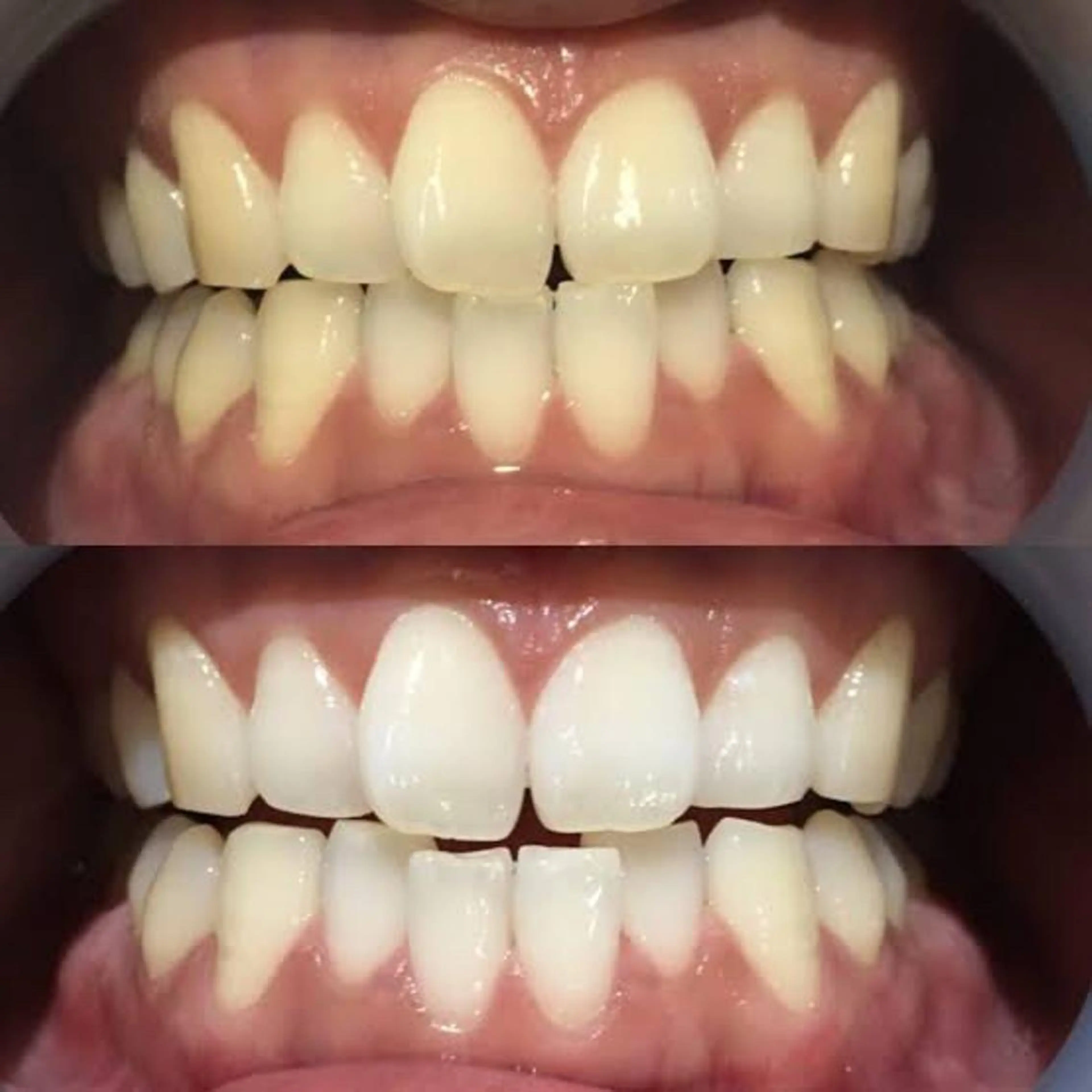 bright所属・eyelash brightのマツエク・マツパデザイン