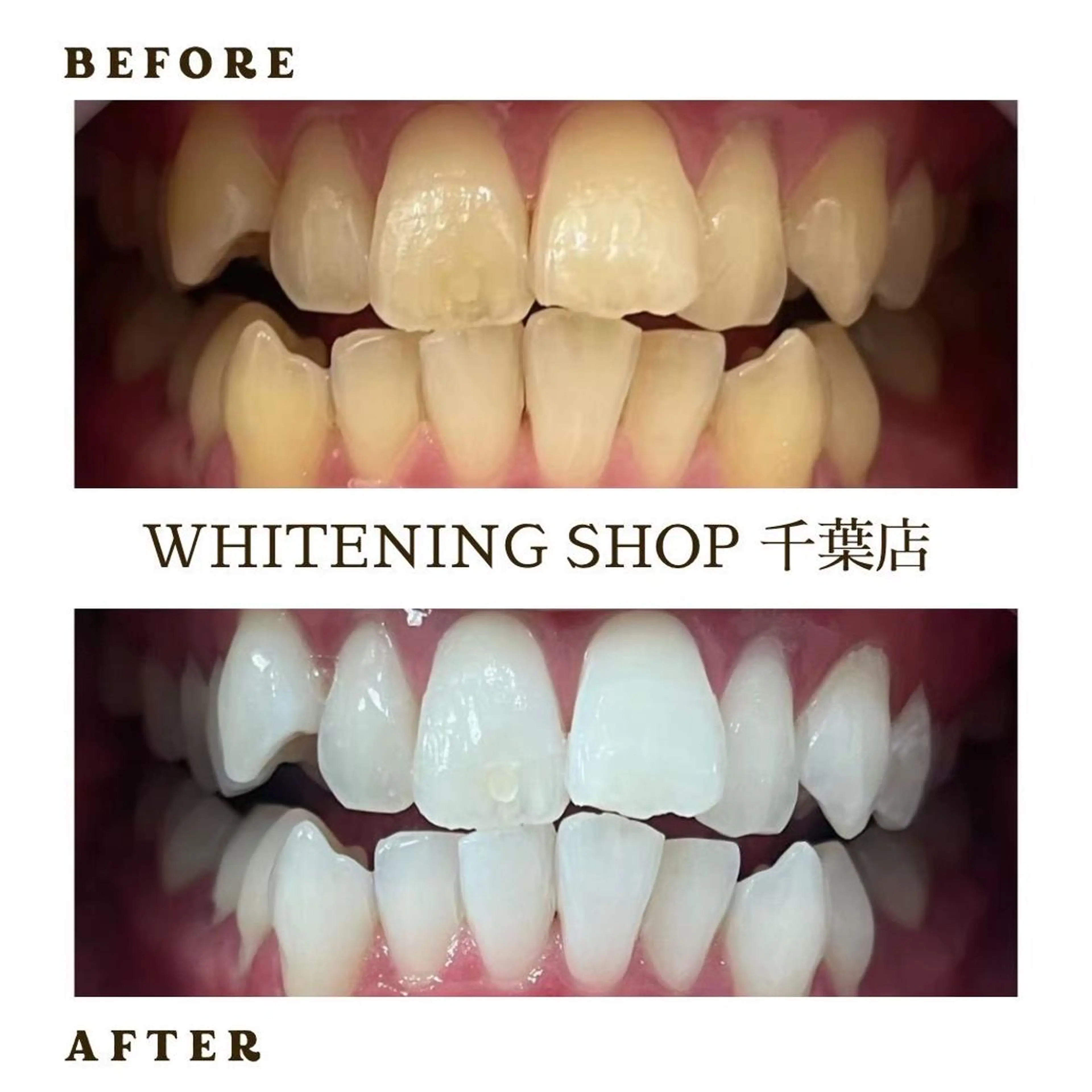 メンズ その他 ホワイトニング ショップ千葉店のその他イメージ