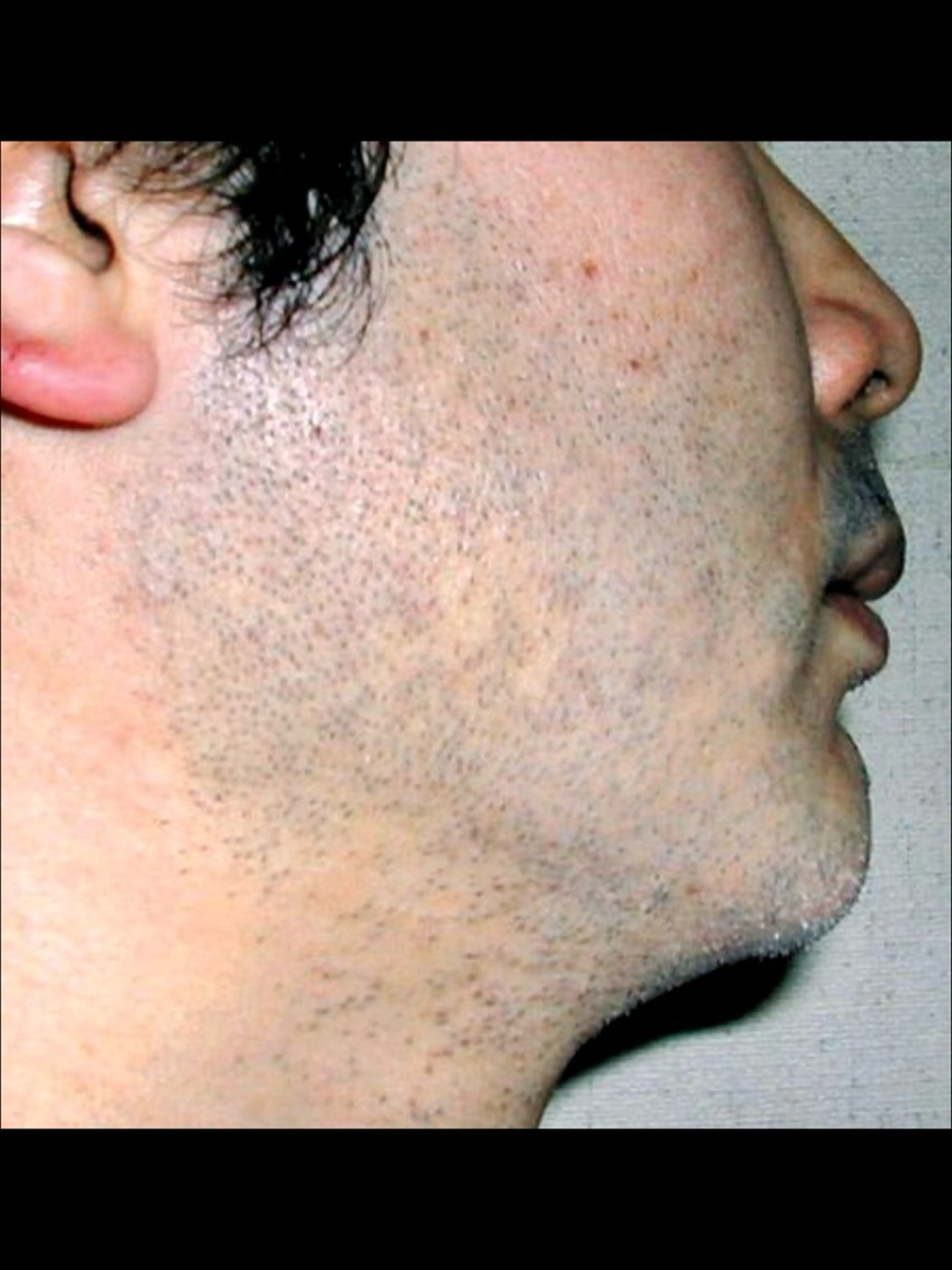 メンズ ☀️Akala☀️ メンズ脱毛のエステ・リラクイメージ