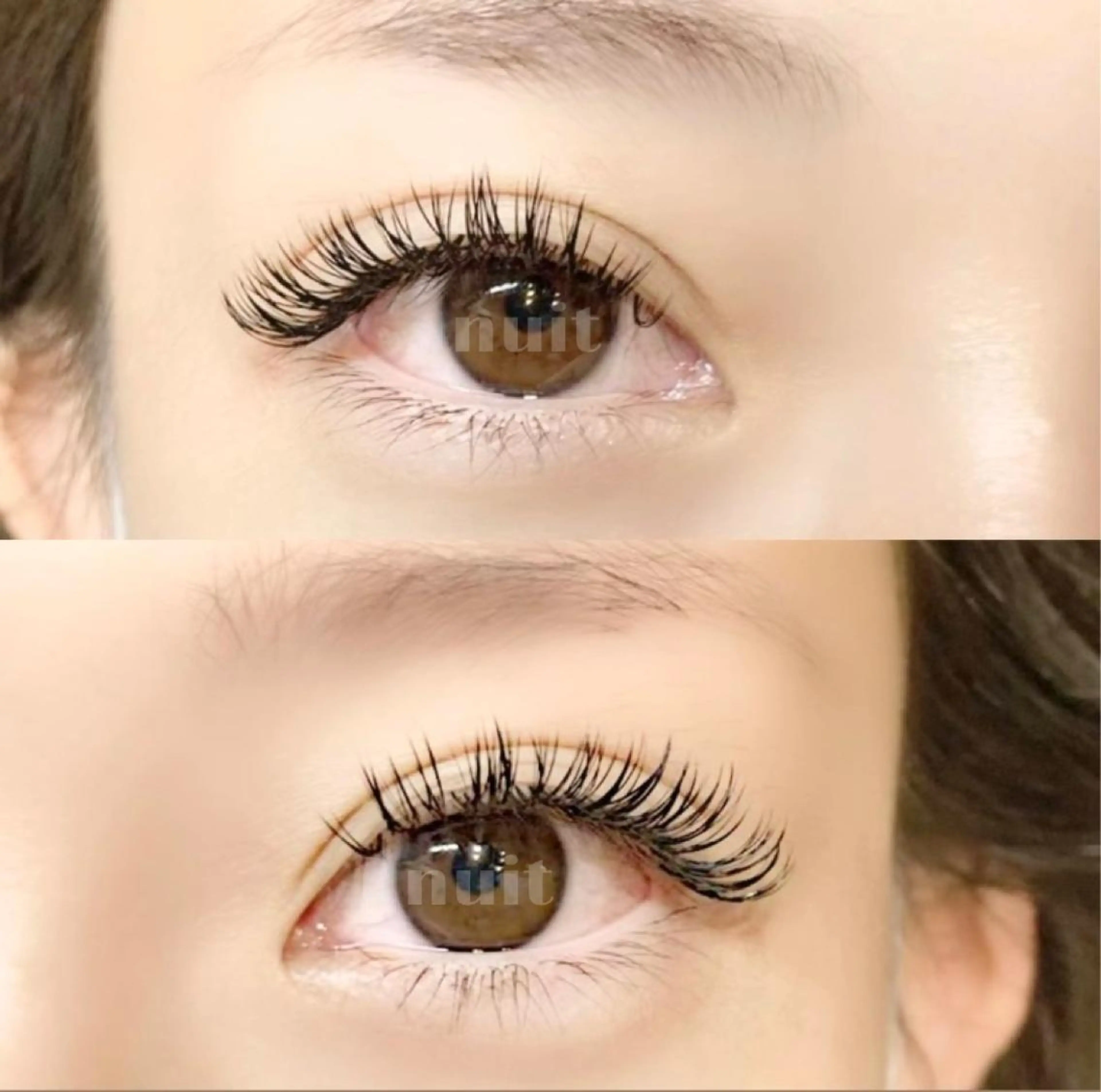 バインドロック　付け放題の写真