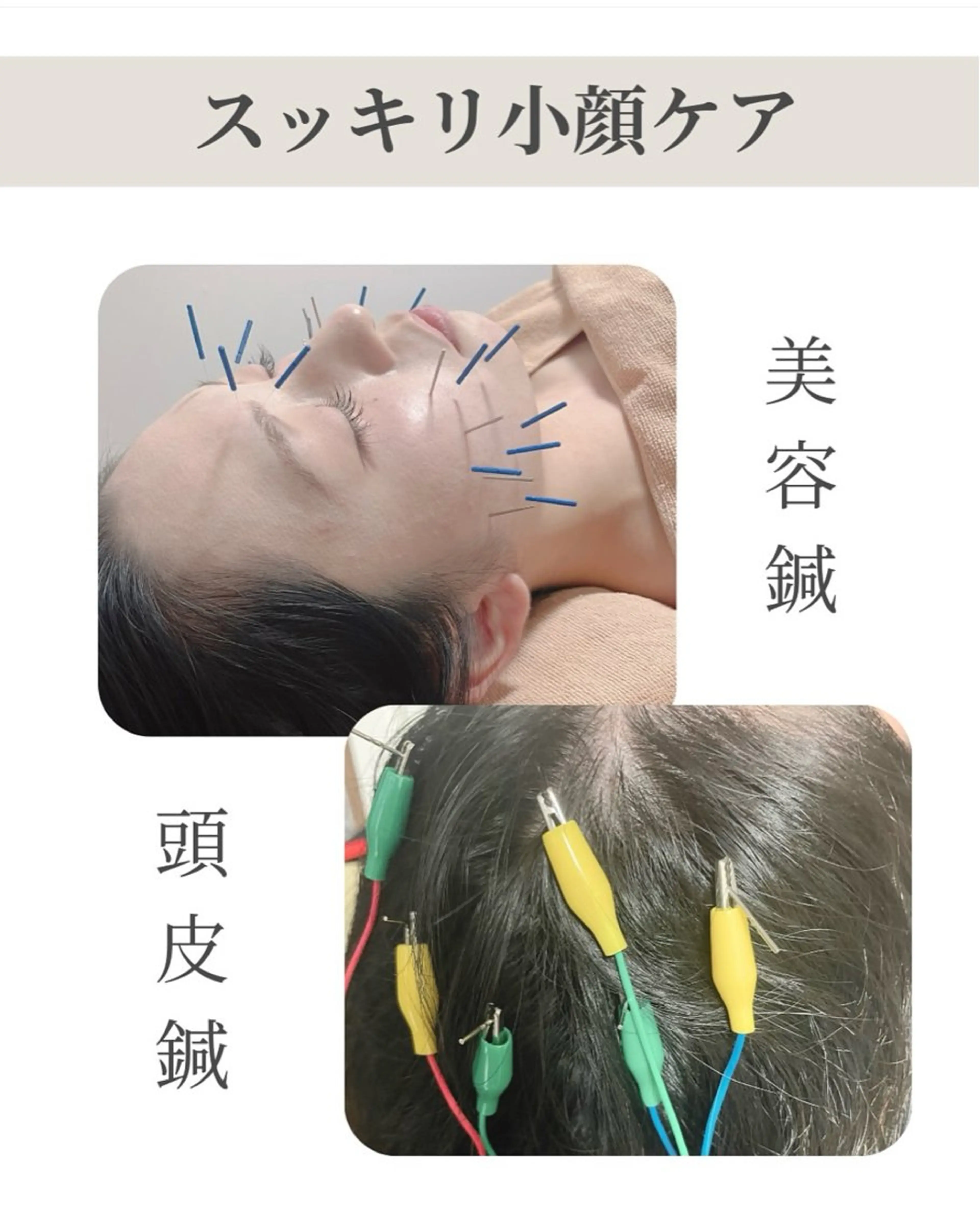 美容鍼/鍼灸 ここみ鍼灸院のエステ・リラクイメージ