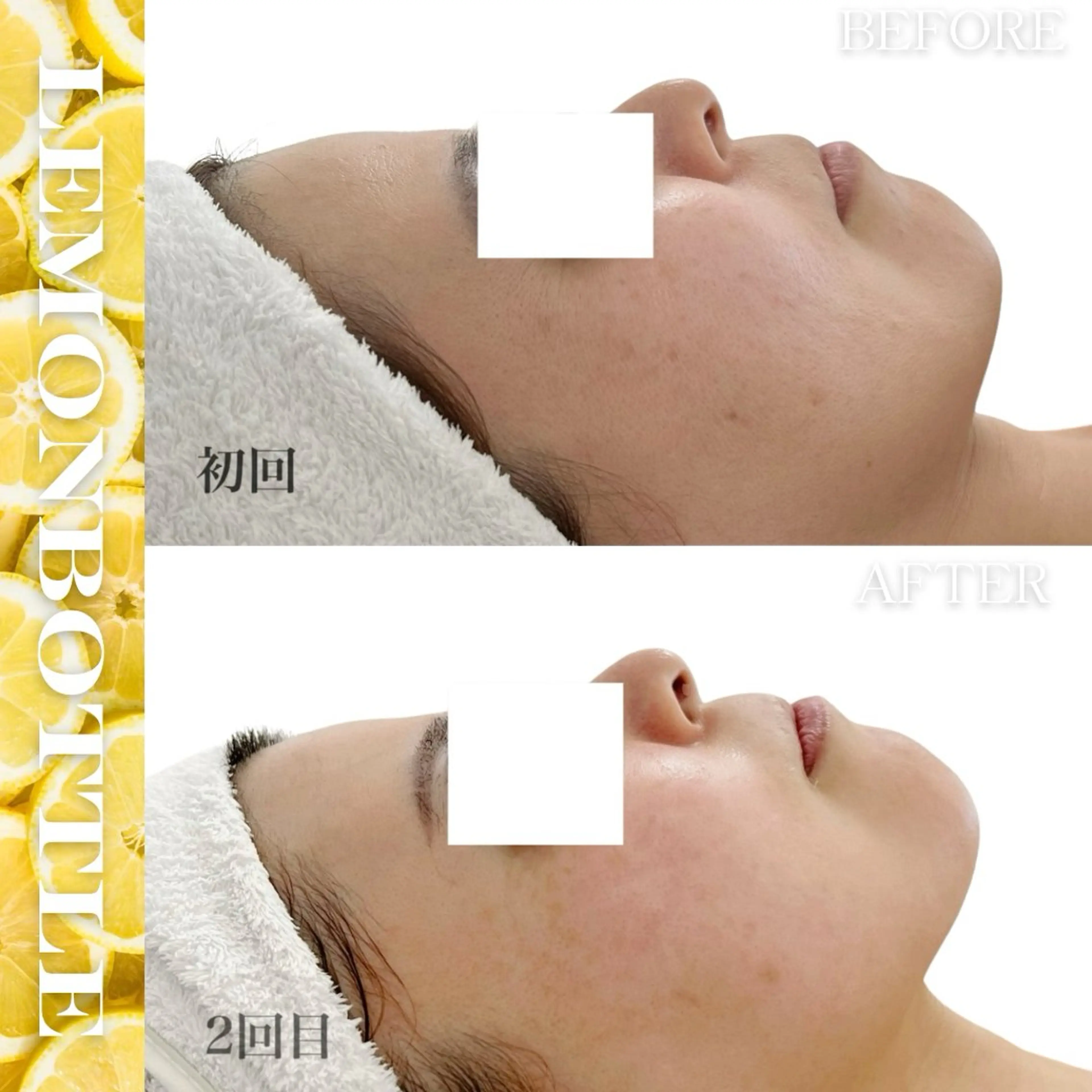 LiAm《美肌管理/ 小顔/脂肪ケア》のその他イメージ