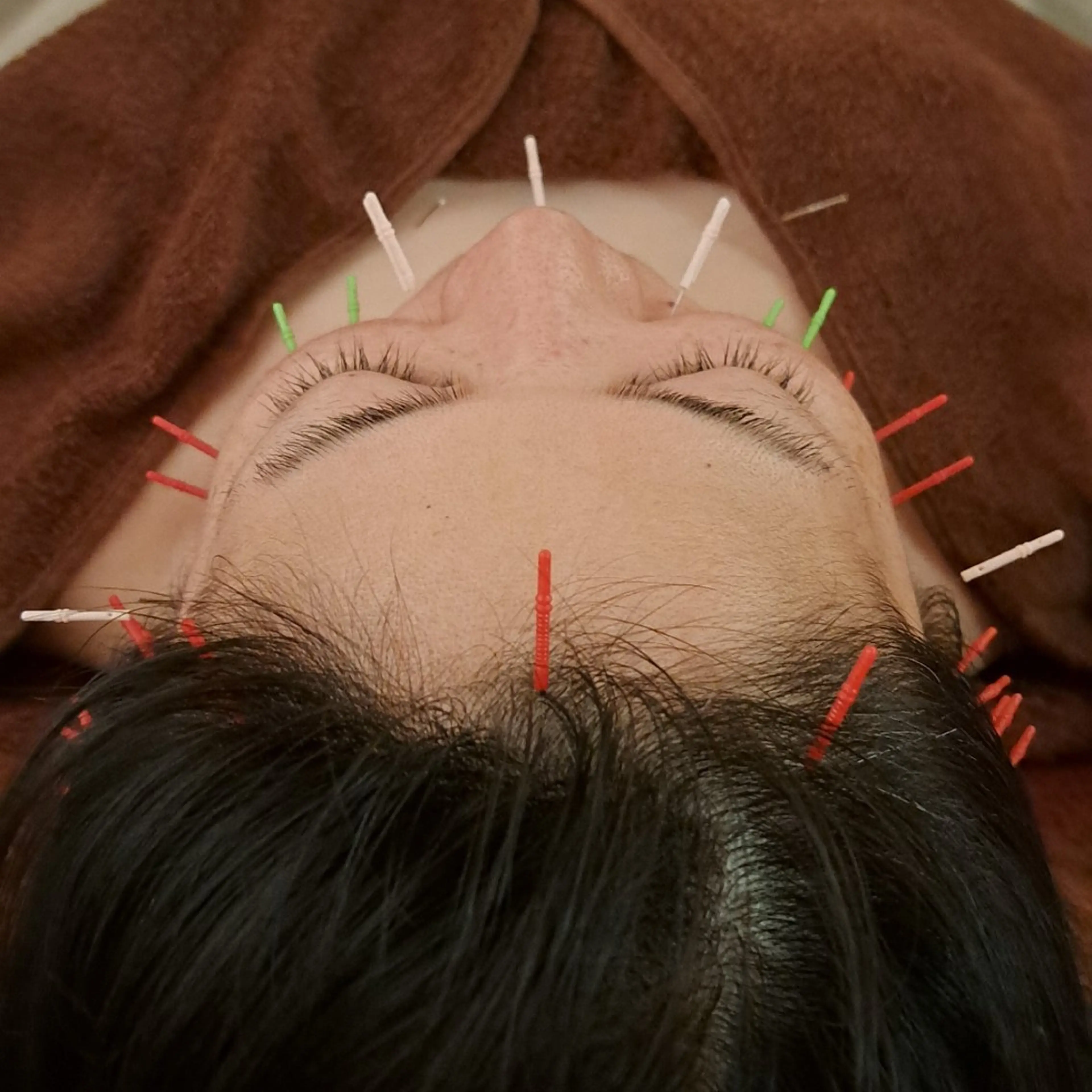 エステ リラク 鍼灸サロンmiyabi所属・美容鍼×エステ 鍼灸 サロンmiyabiのエステ・リラクイメージ