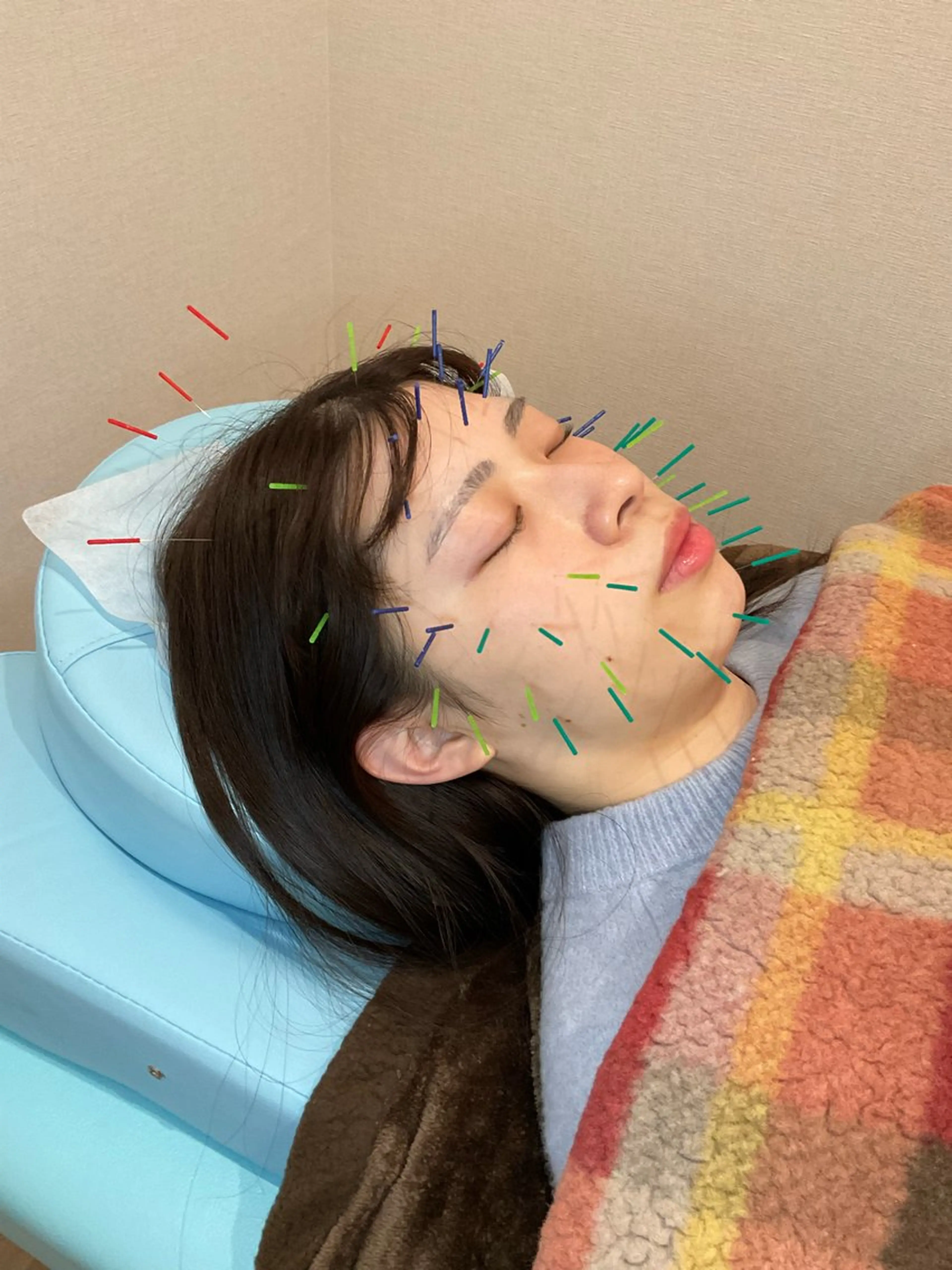 エステ リラク けい整骨院 鍼灸院のその他イメージ