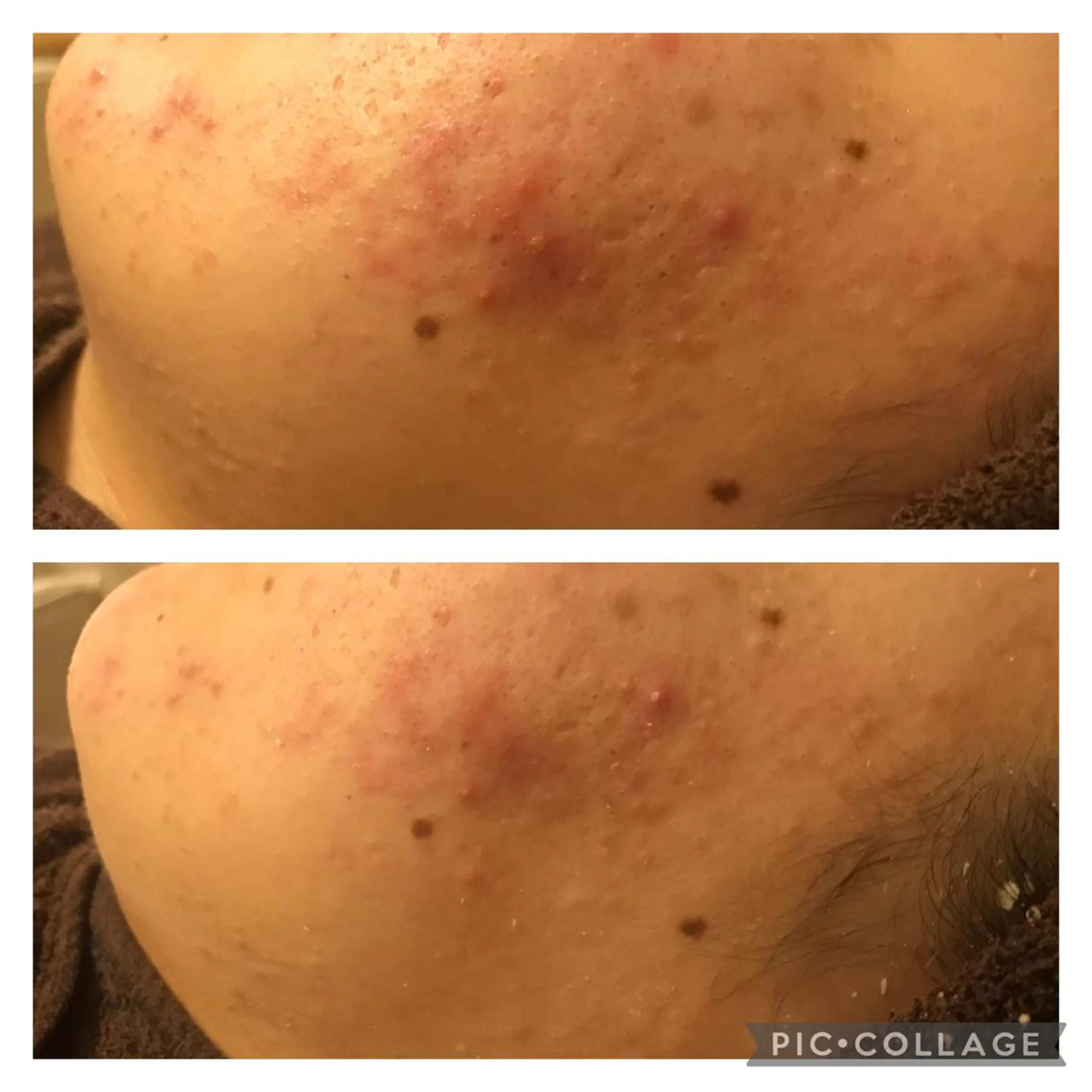 ミディアム カラー パーマ ヘアアレンジ メンズ キッズ ネイル マツエク・マツパ アニメ,Vオタク× 即効痩せエステサロンのエステ・リラクイメージ