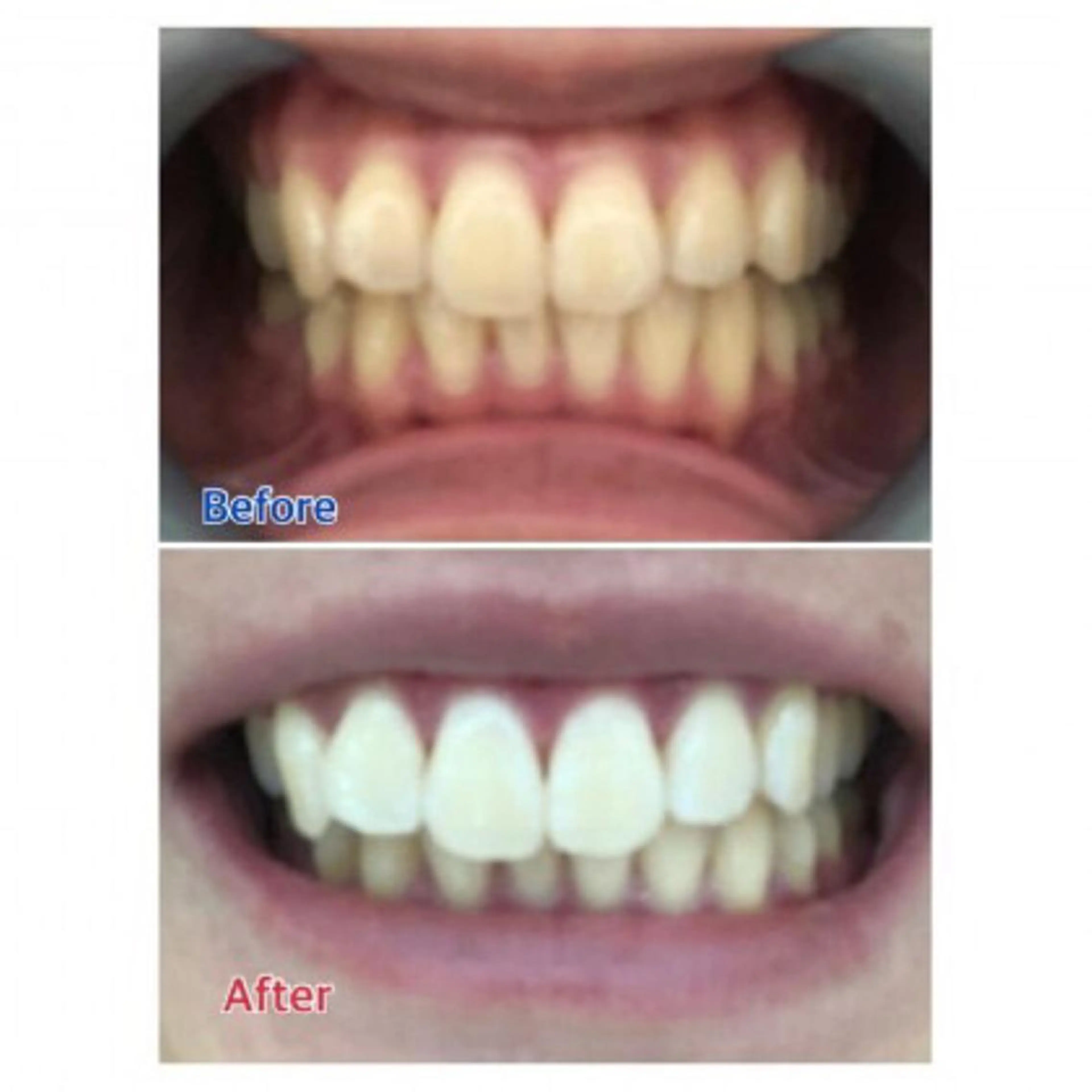 Ｍ渋谷 ホワイトニングのエステ・リラクイメージ