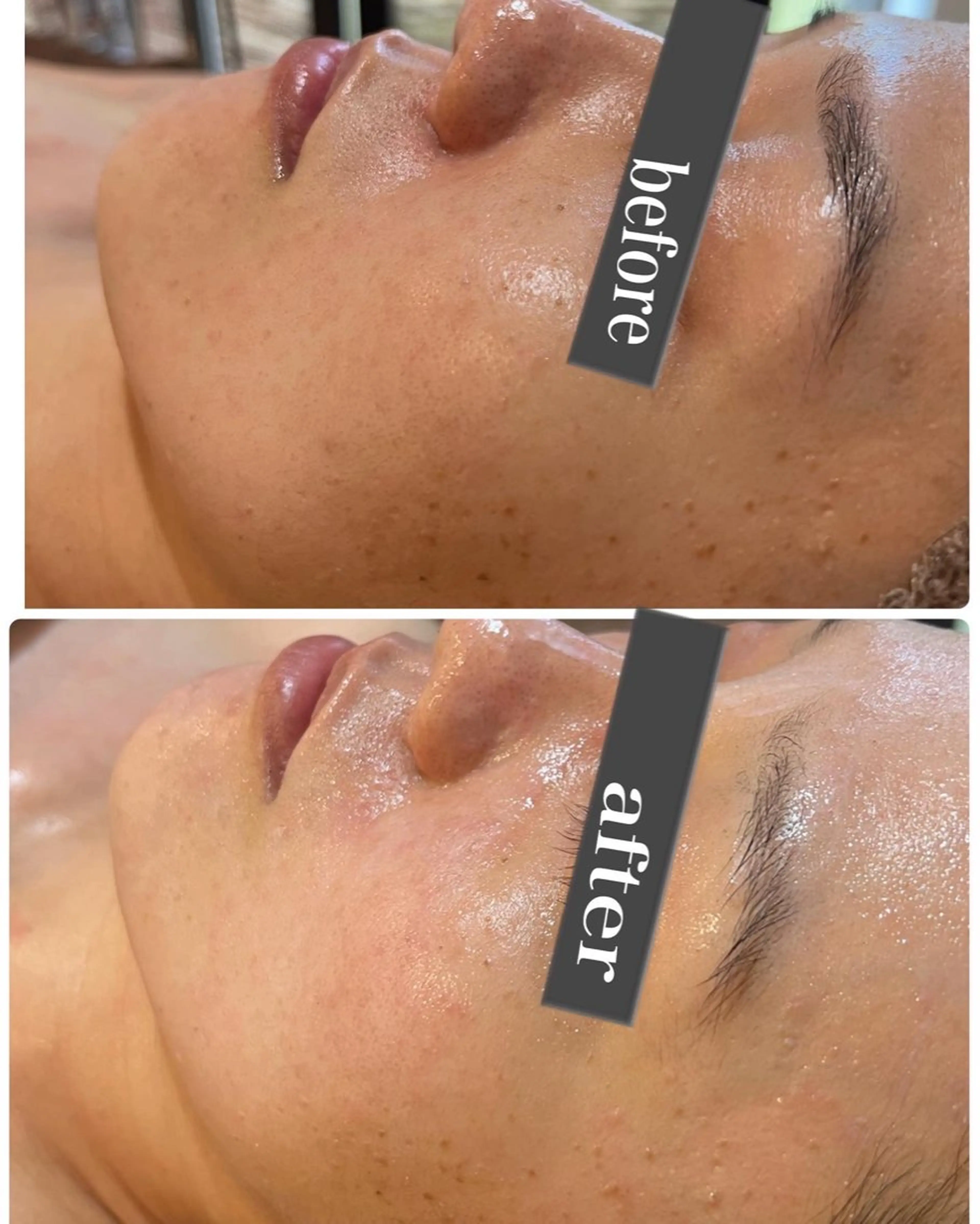 エステ ハーブ/小顔/リンパ /大阪狭山市のエステ・リラクイメージ