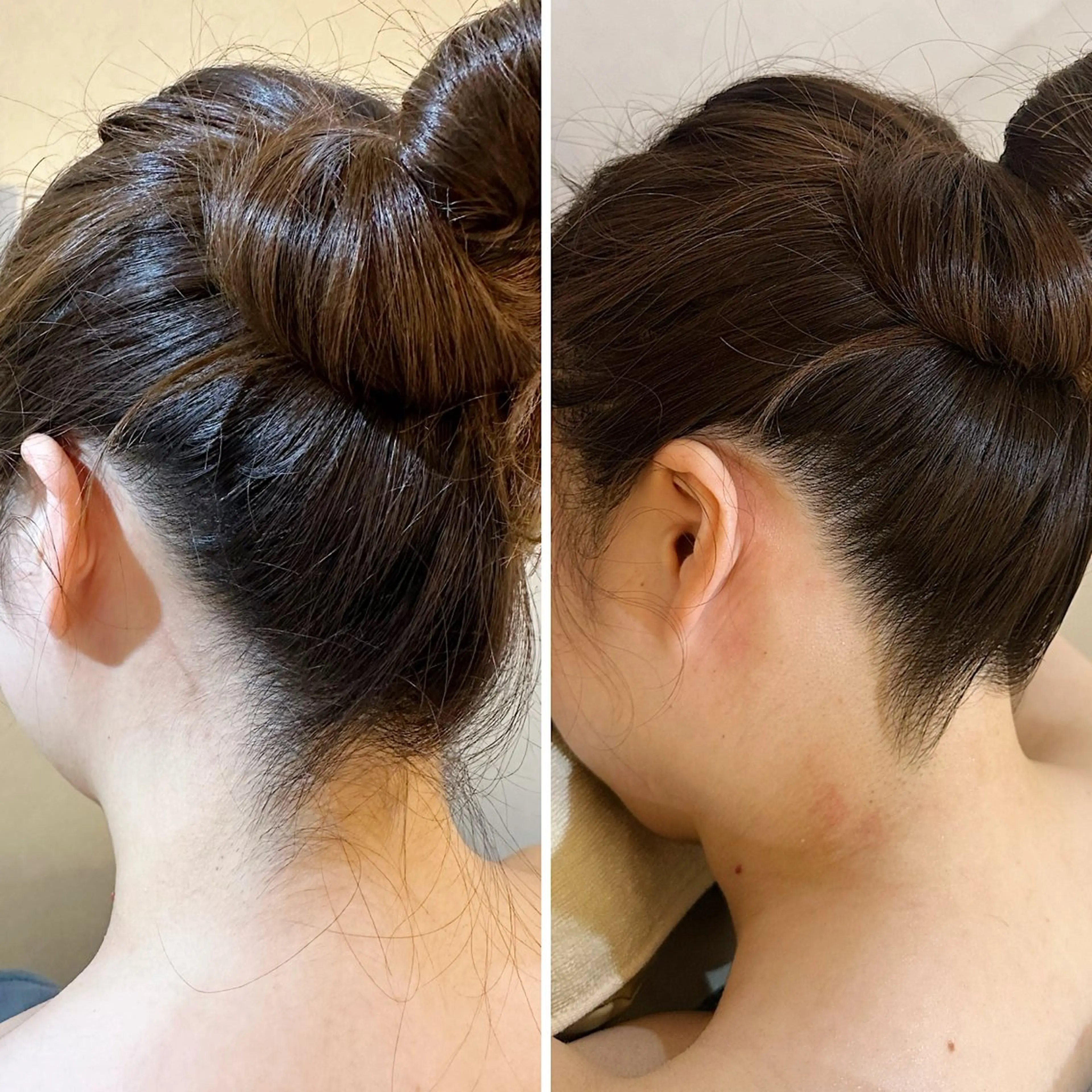 脱毛 うなじ脱毛/美肌脱毛 LABELのエステ・リラクイメージ