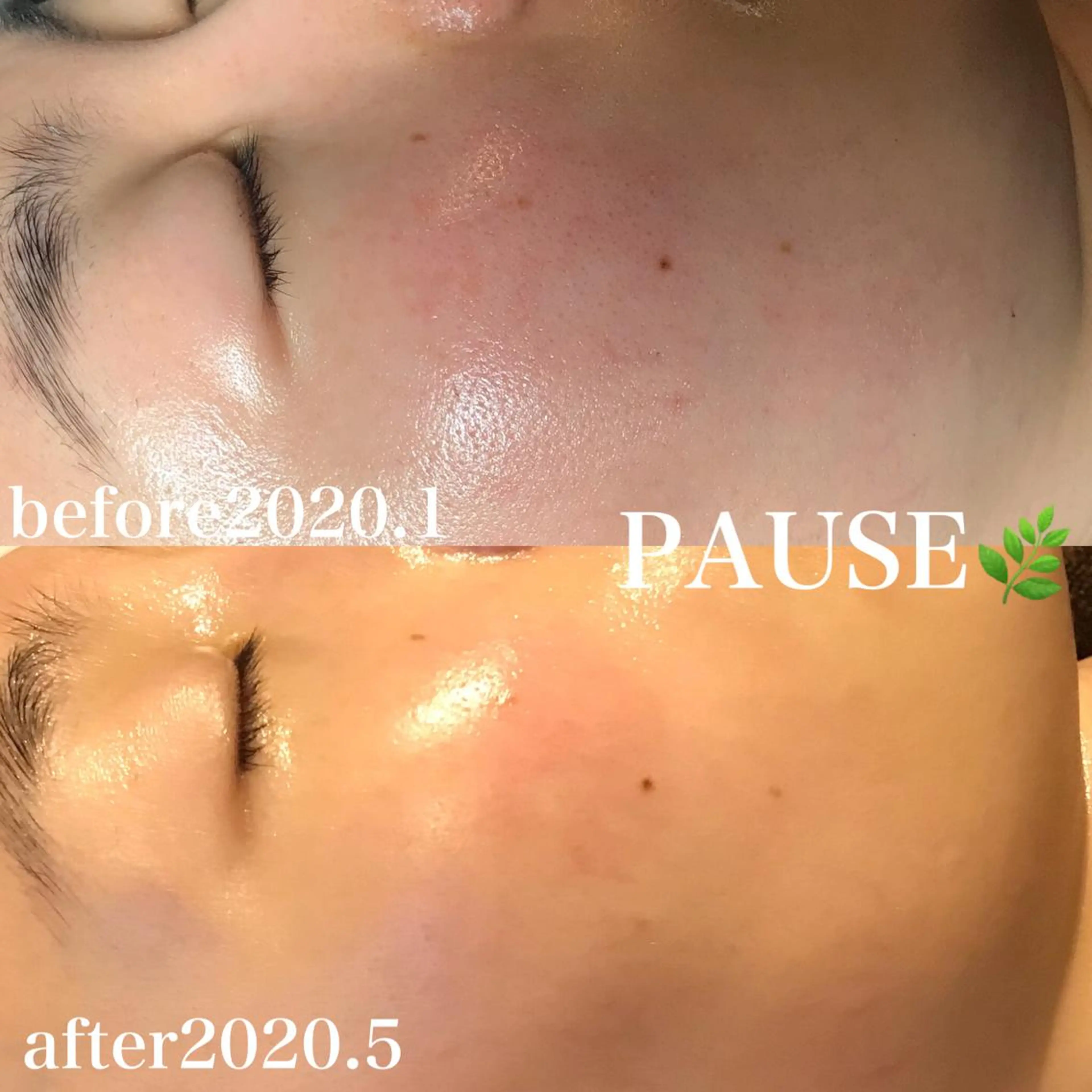 エステ 浜野 恵美のエステ・リラクイメージ