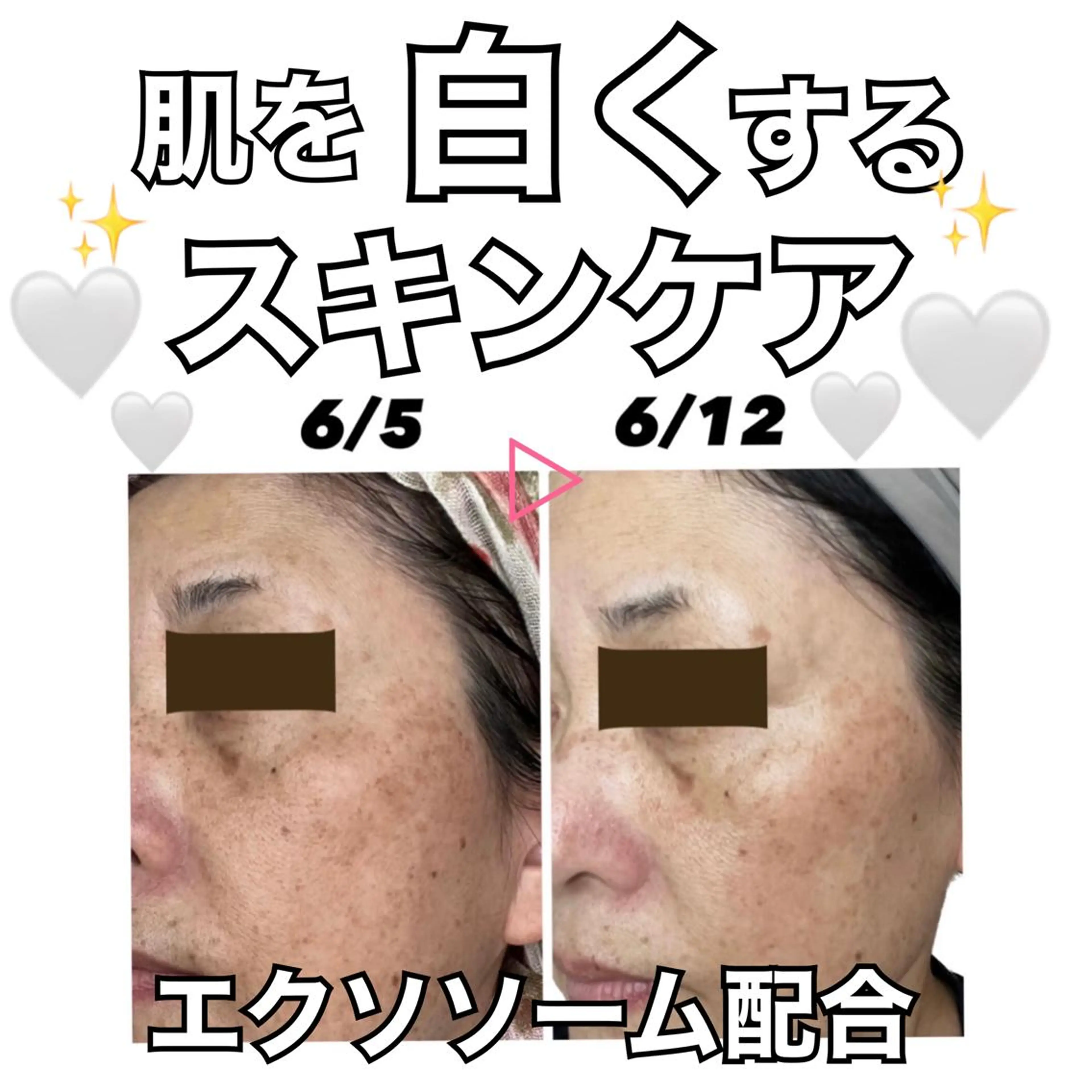 stella都度払い 痩身小顔まつげパーマのマツエク・マツパデザイン