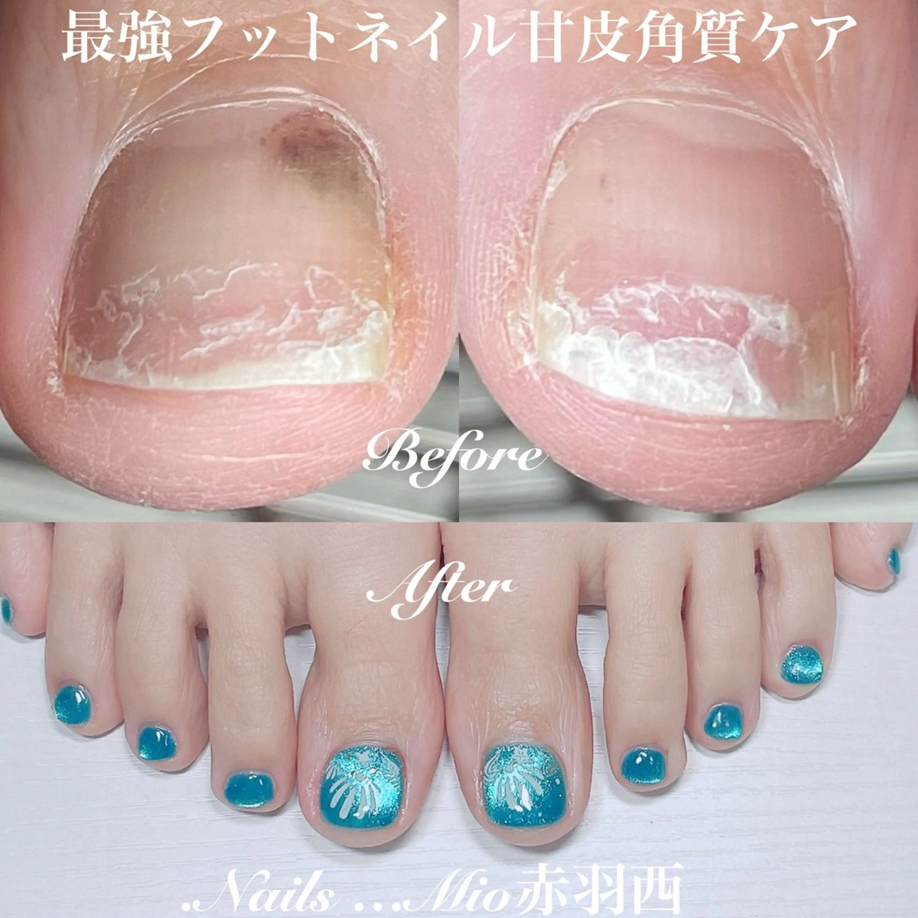 ネイル アートネイル フットネイル ジェルネイル マグネットネイル 赤色 .Nails Mio 赤羽西ネイルサロンのネイルデザイン