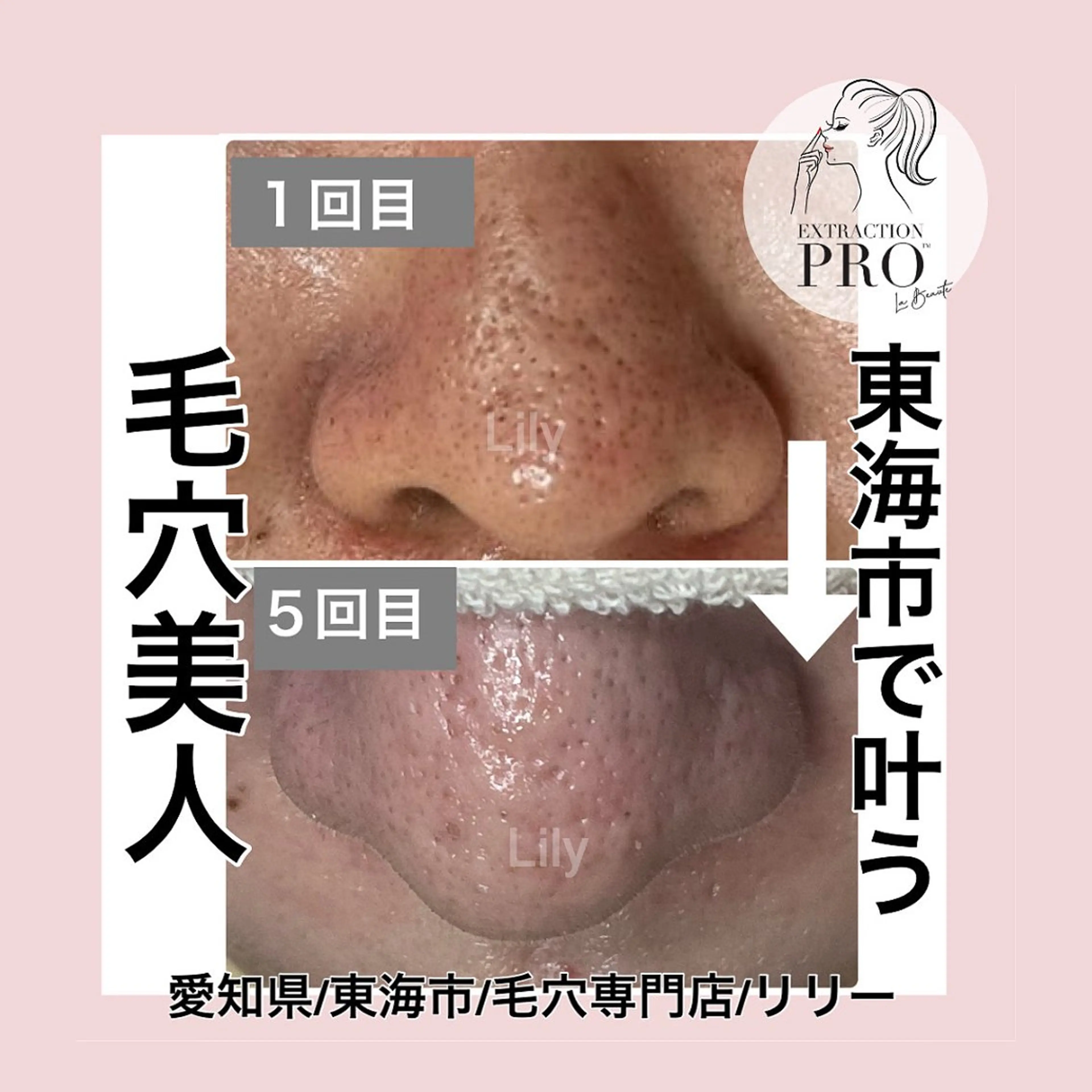 トータルビューティー サロンLilyのエステ・リラクイメージ