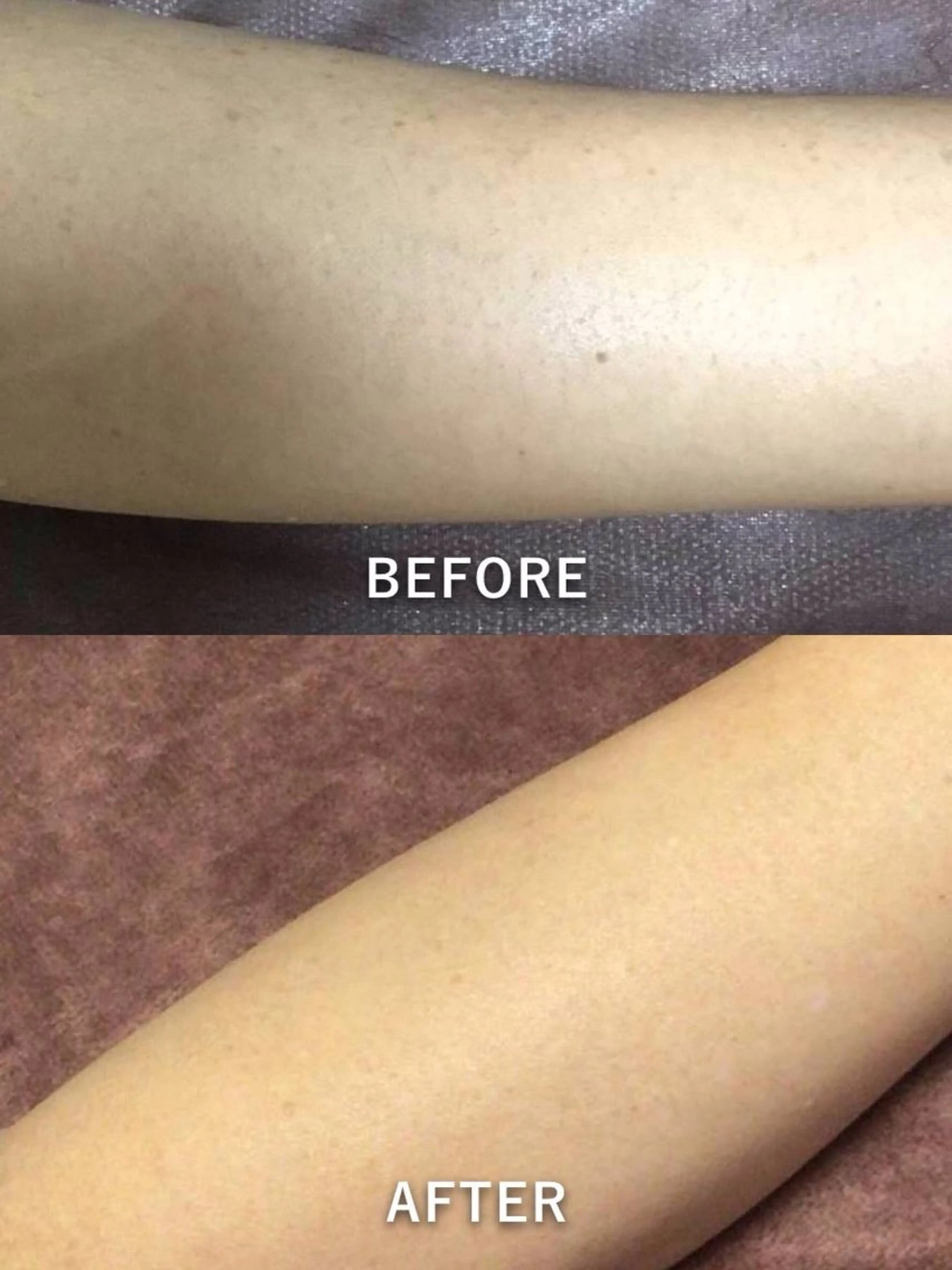 エステ 仲澤 千春のその他イメージ