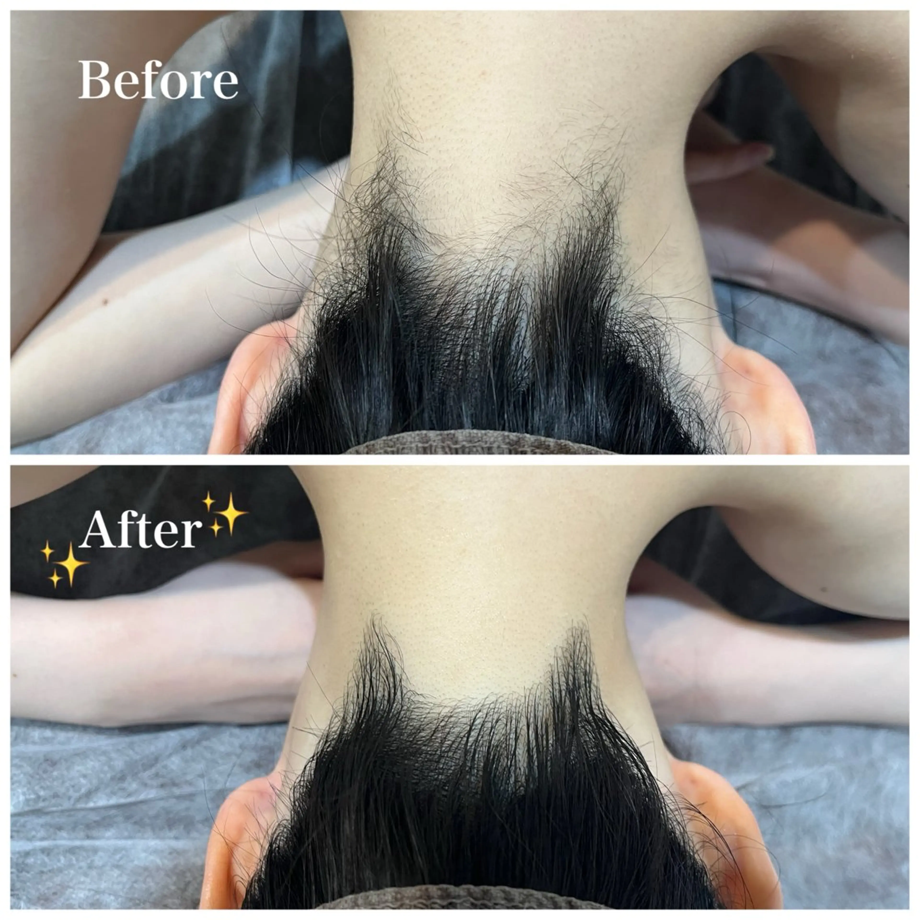 脱毛 脱毛サロン fam.豊澤柚良のエステ・リラクイメージ