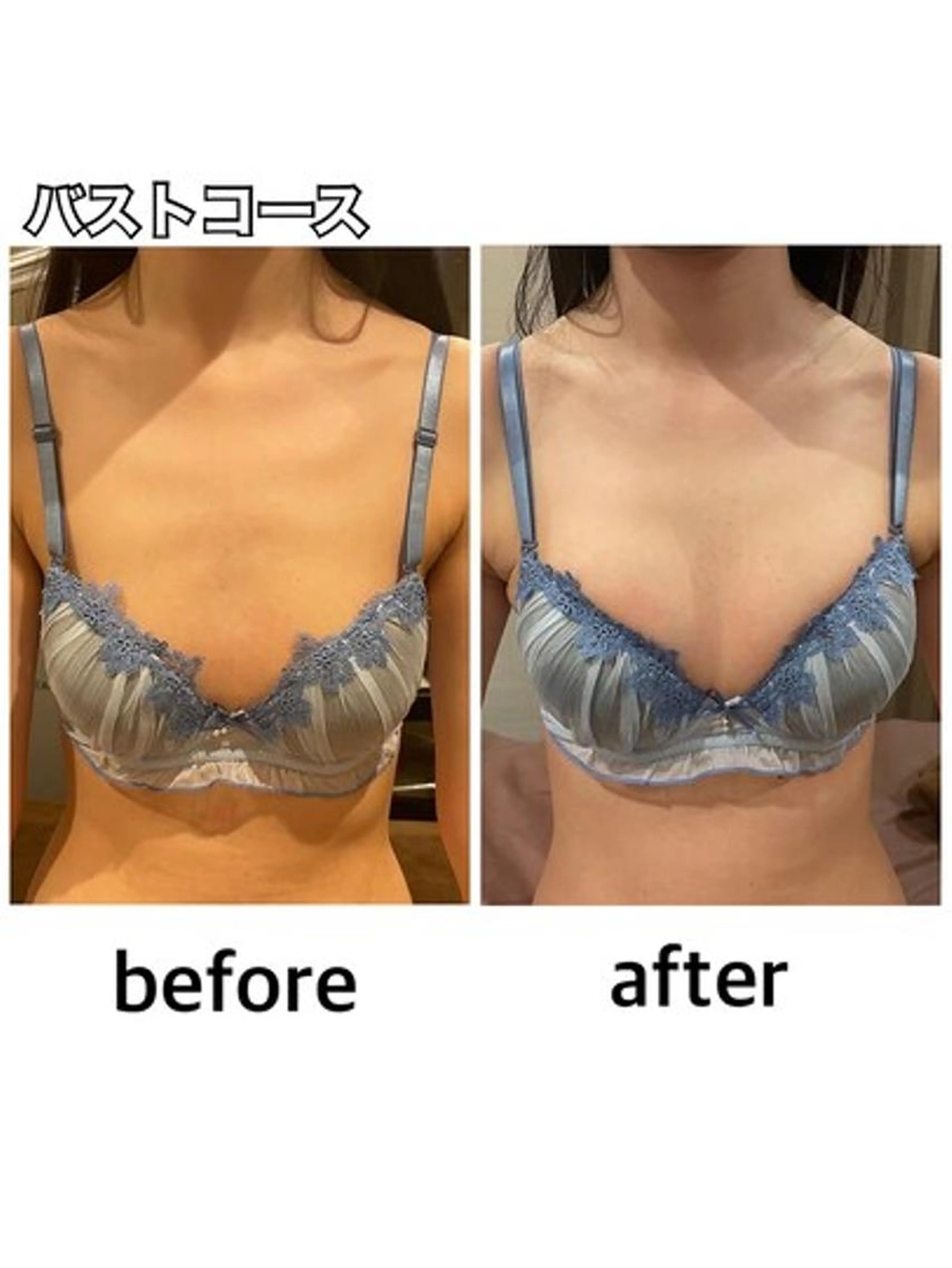 🌹本気でバストアップしたい方🌹《Specialバストケア》8980円→3980円の写真