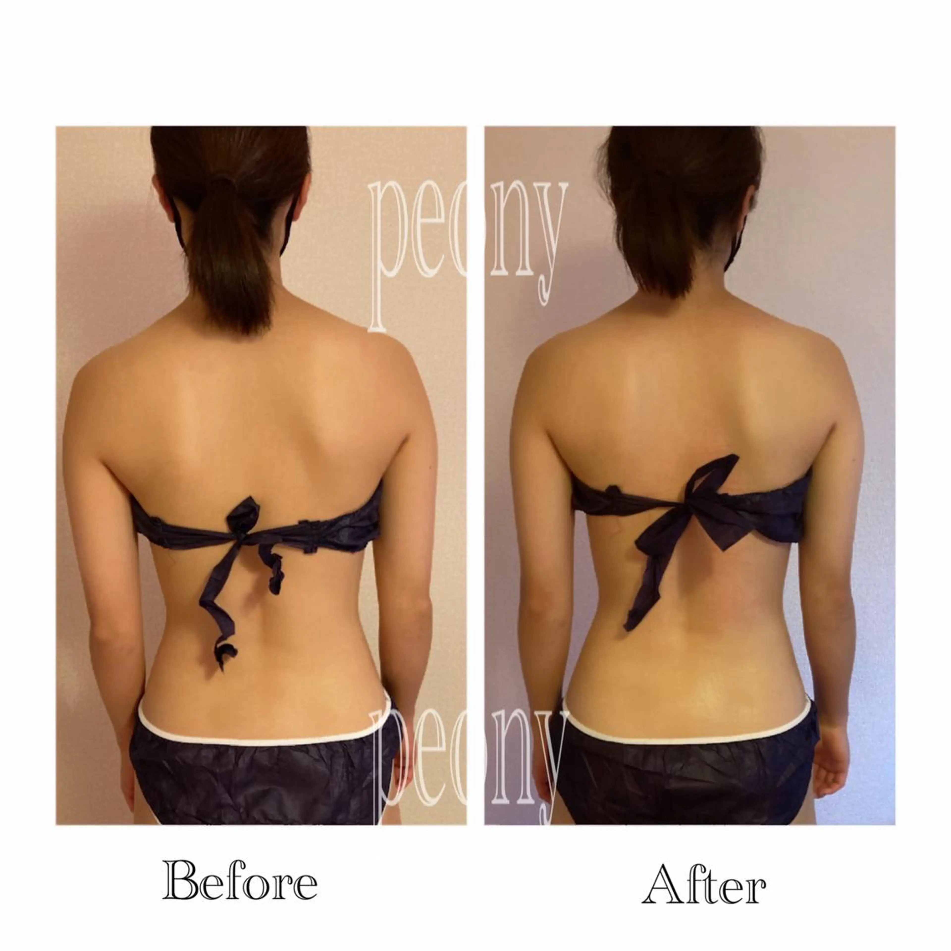 エステ デトックス美容専門サロンpeony所属・デトックス美容専門 サロンpeonyのエステ・リラクイメージ