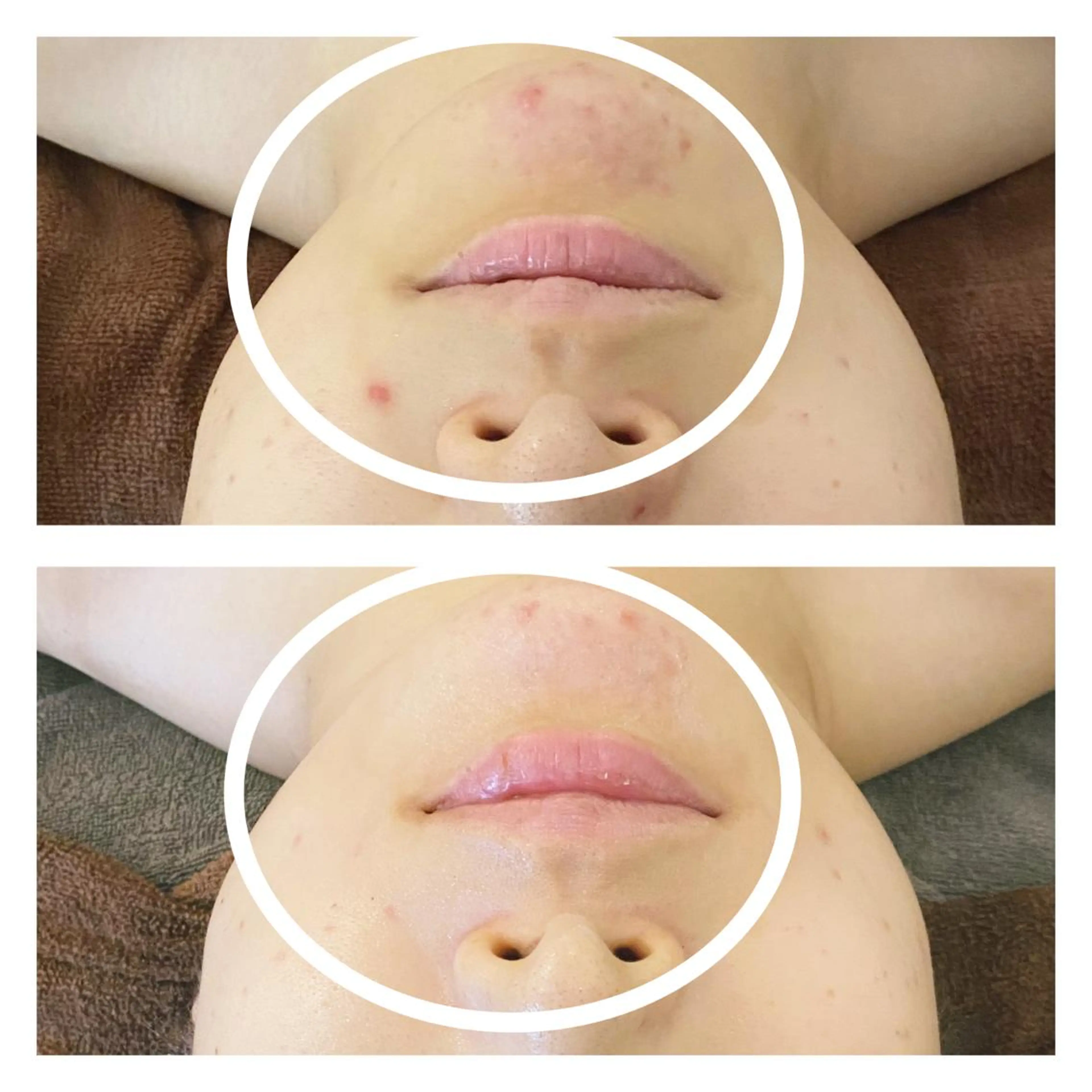 エステ リラク 小顔EX心斎橋 REVIハーブのエステ・リラクイメージ