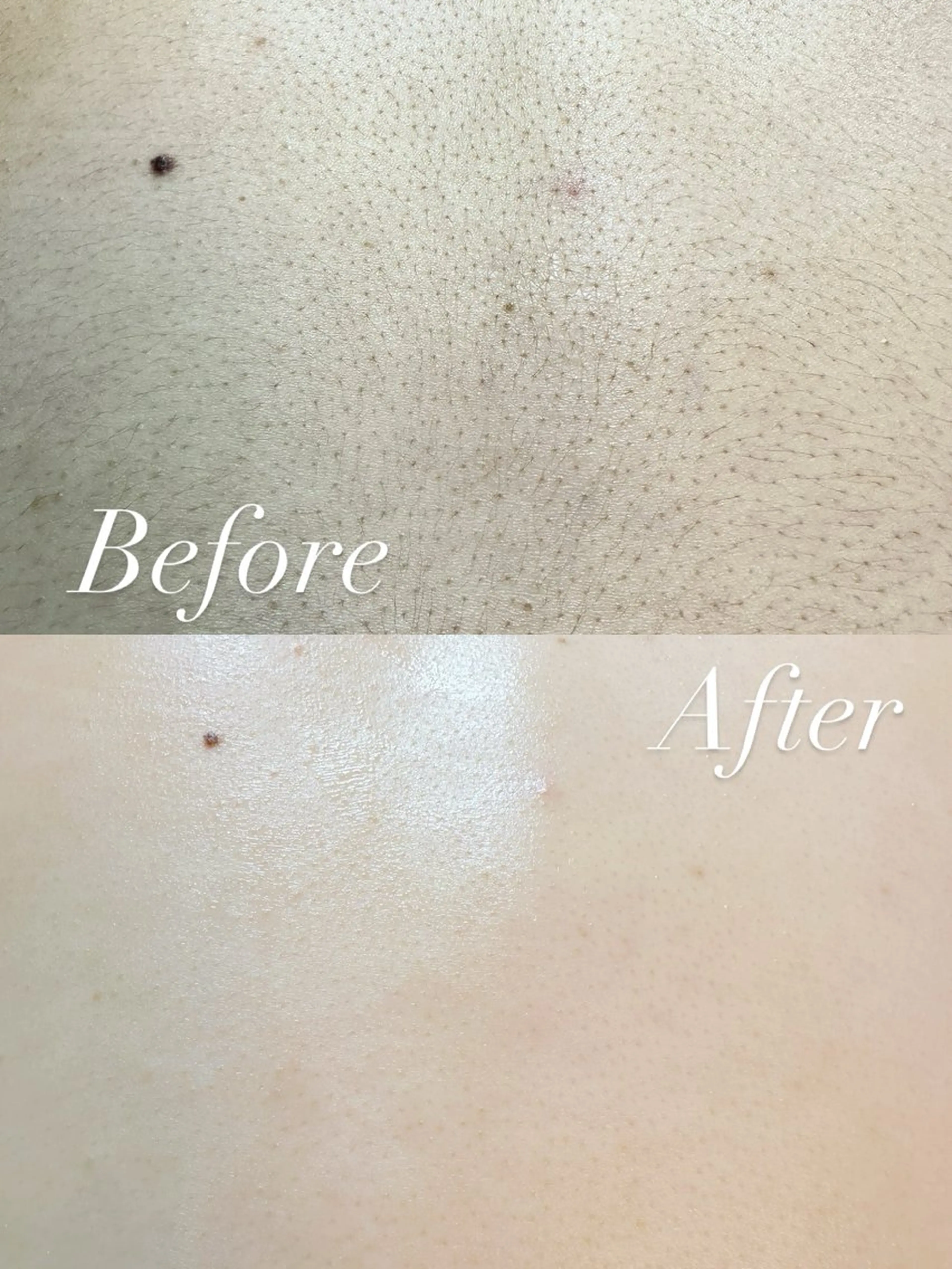 Hitomi シュガーリング豊橋のその他イメージ