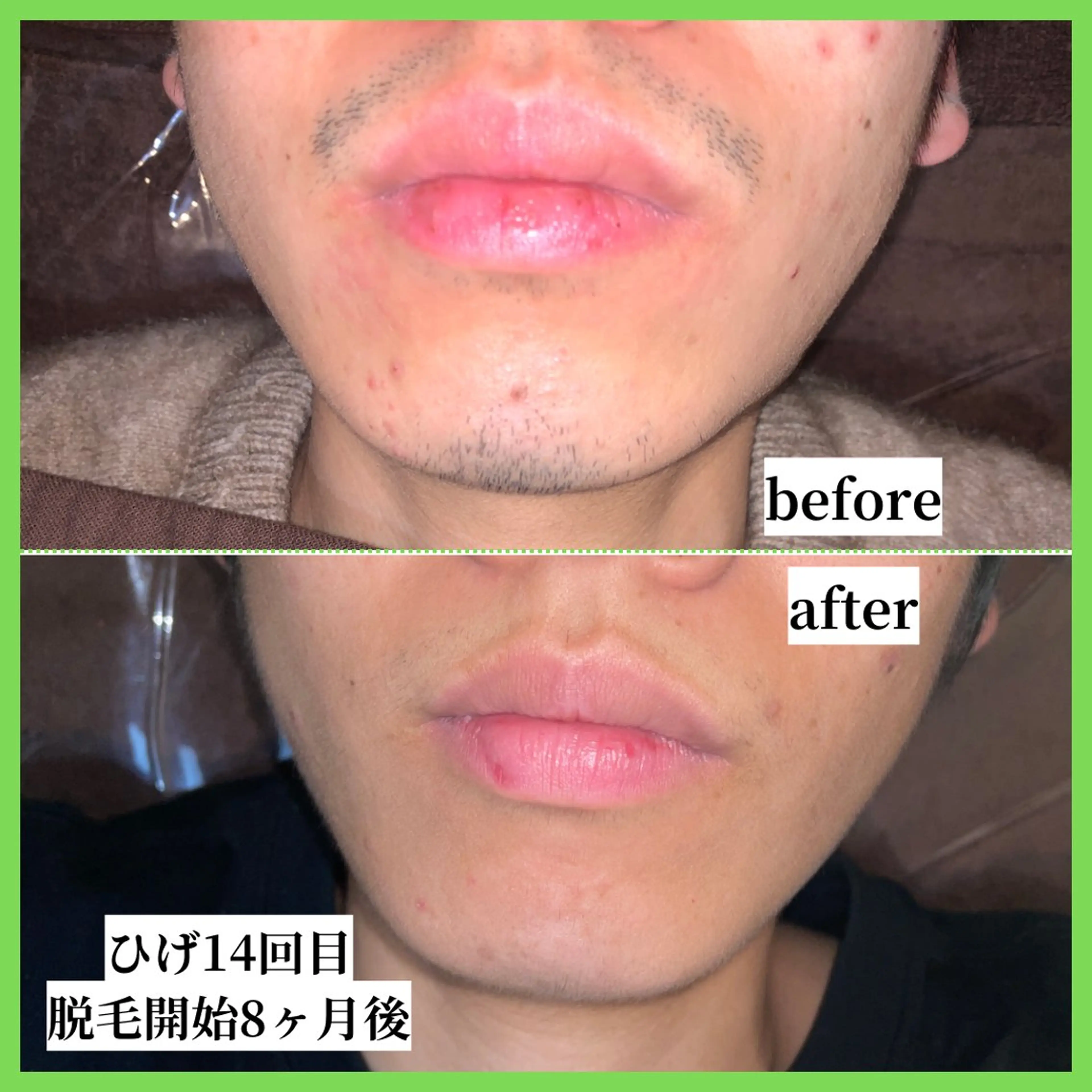 メンズ 脱毛 【天神|個室】脱毛 You Makeのエステ・リラクイメージ