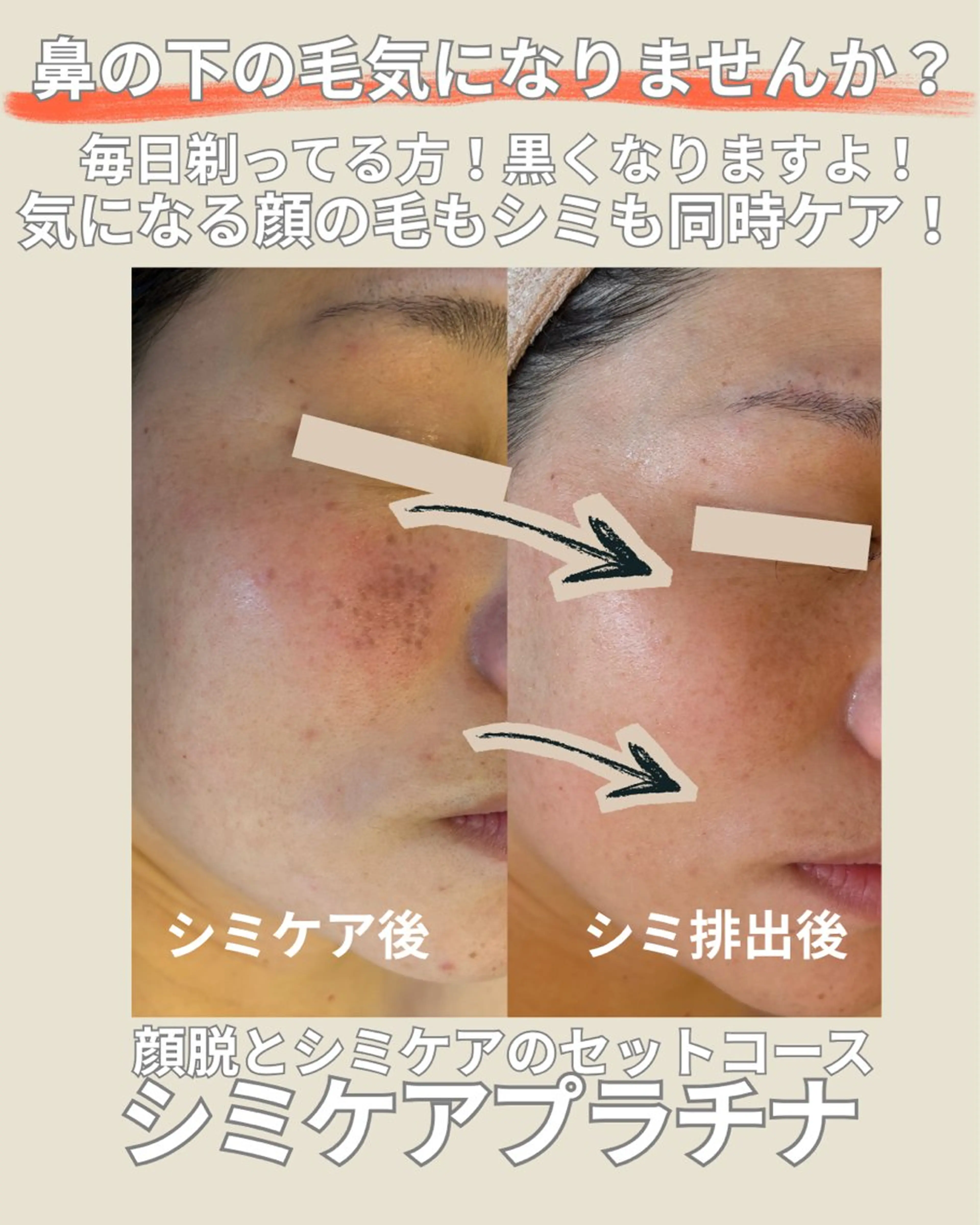 エステ エステサロン グラマラスのエステ・リラクイメージ