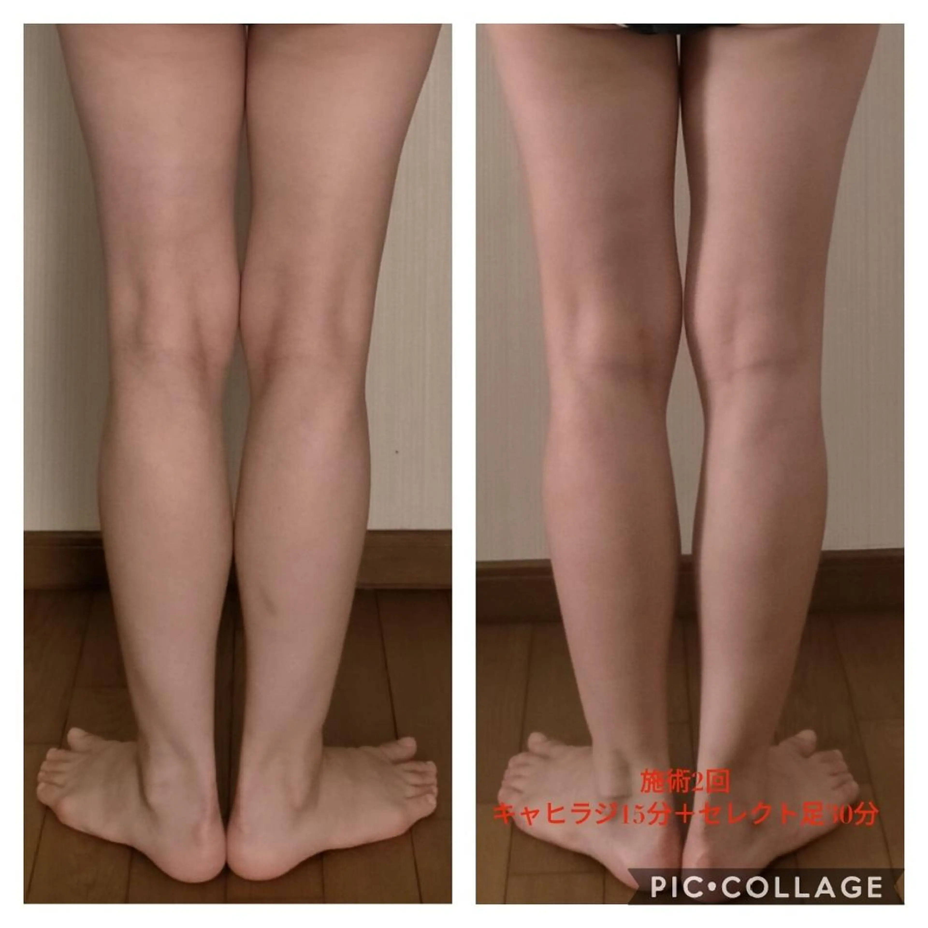〈オイルケア〉すらっと美脚ケア💓（60分）最速で隙間をつくる💖美脚リンパ徹底ケア✨の写真