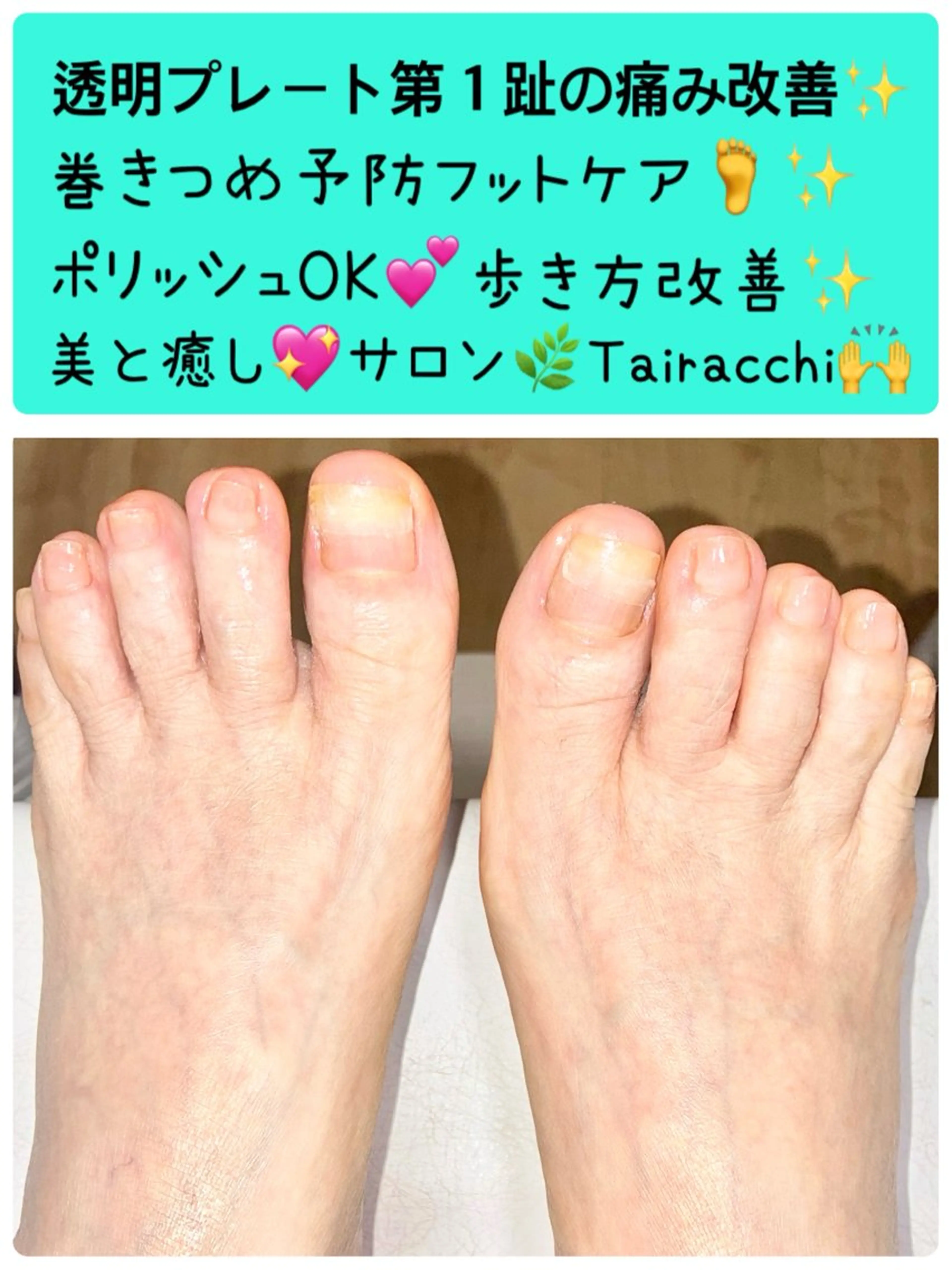 ネイル フットネイル Tairacchi ﾀｲﾗｯﾁのエステ・リラクイメージ