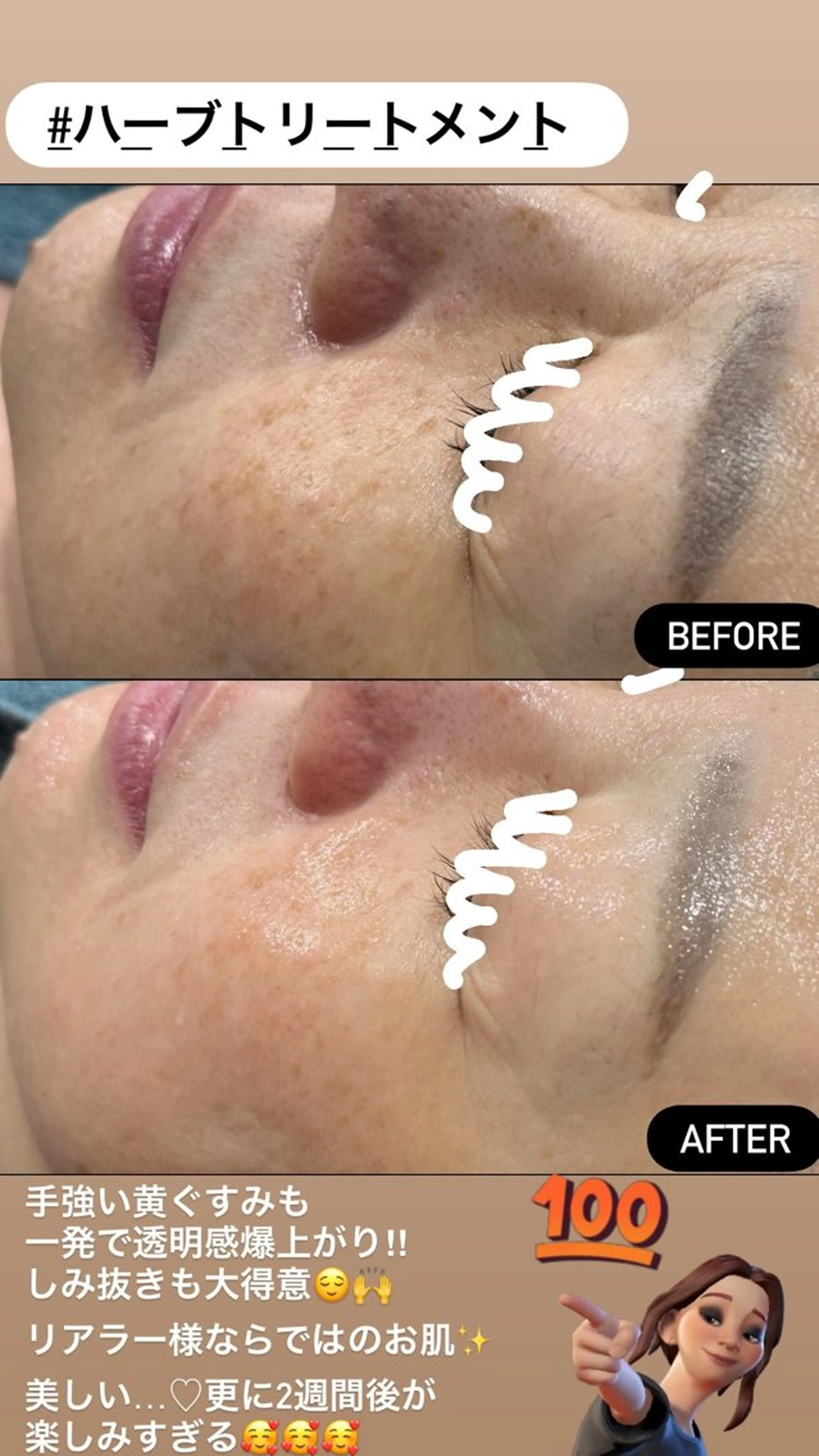 エステ LiZA エステティックサロンのエステ・リラクイメージ