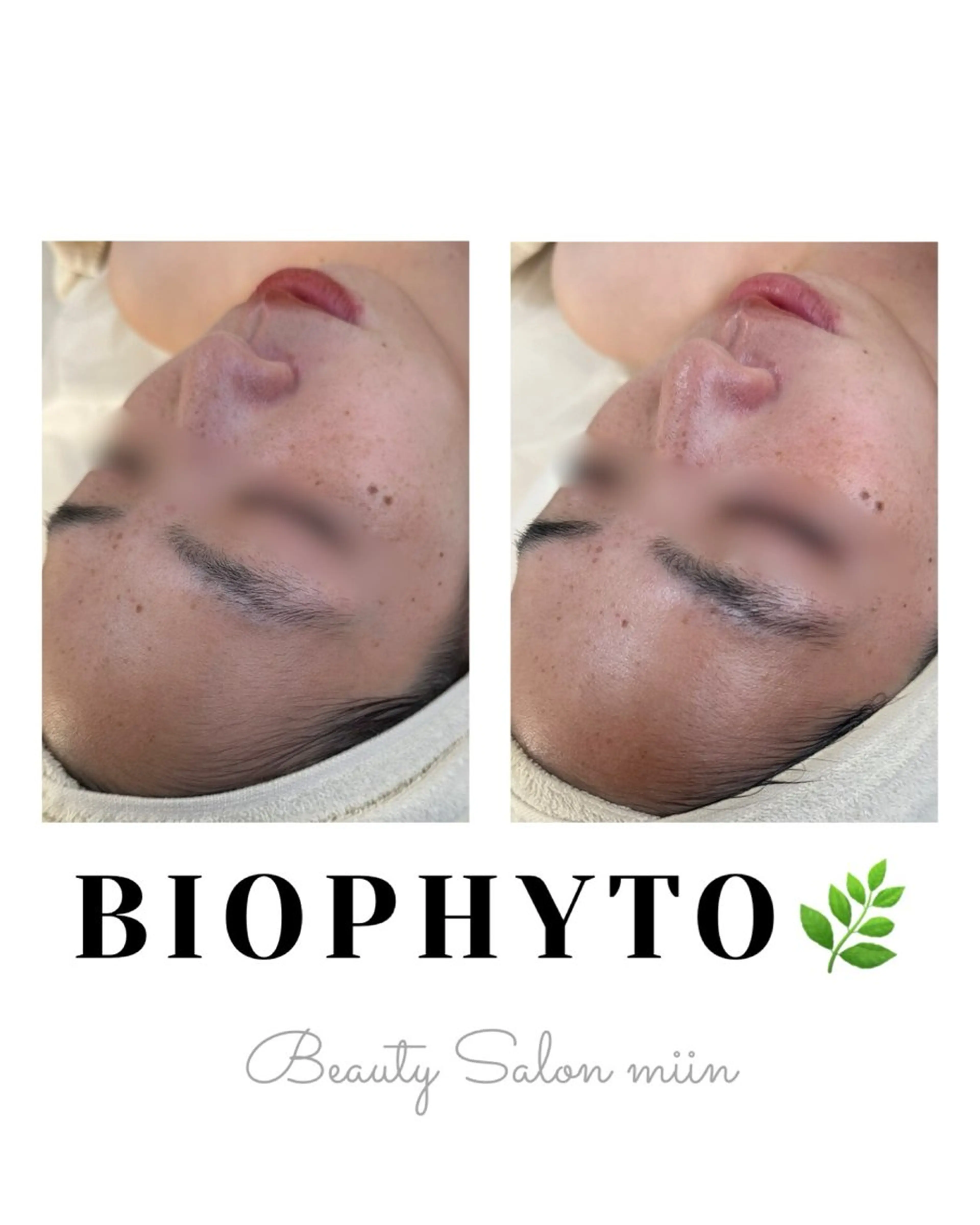 エステ 韓国肌管理 白玉肌管理®︎のエステ・リラクイメージ