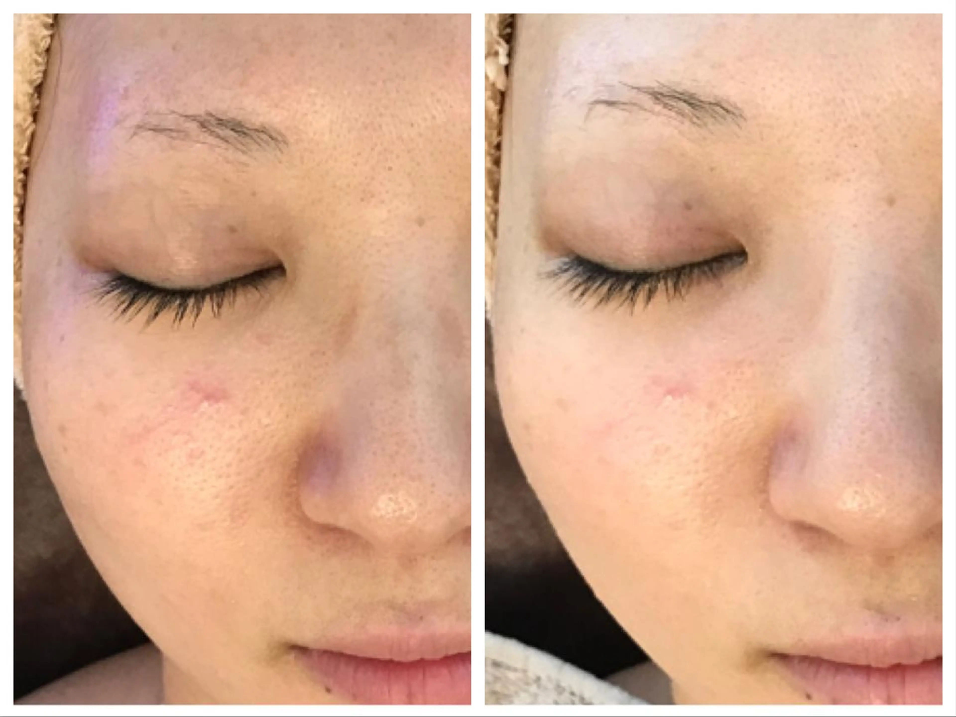 セレーネボーテプラス ローマピンク福岡のエステ・リラクイメージ