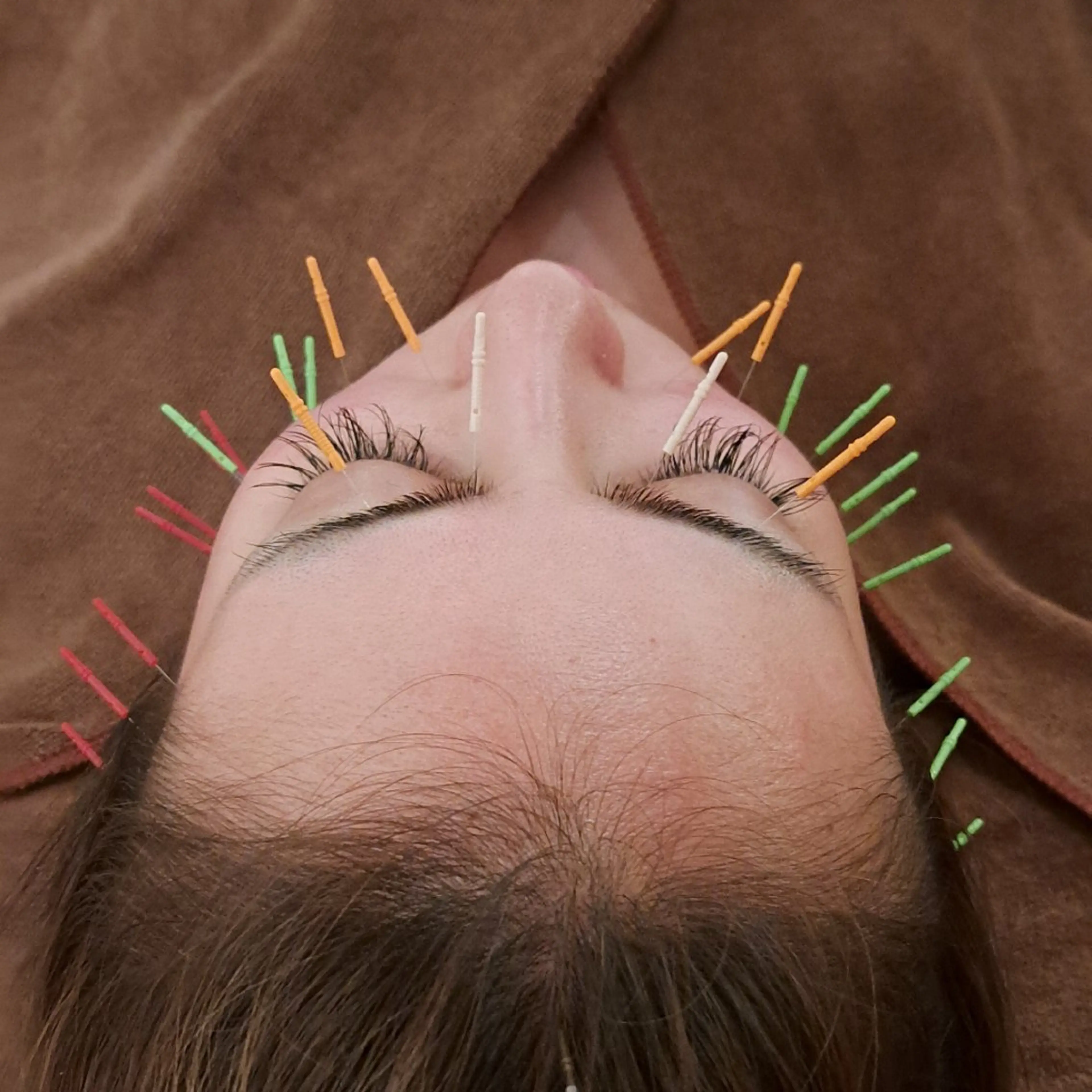 エステ リラク 鍼灸サロンmiyabi所属・美容鍼×エステ　鍼灸 サロンmiyabiのエステ・リラクイメージ