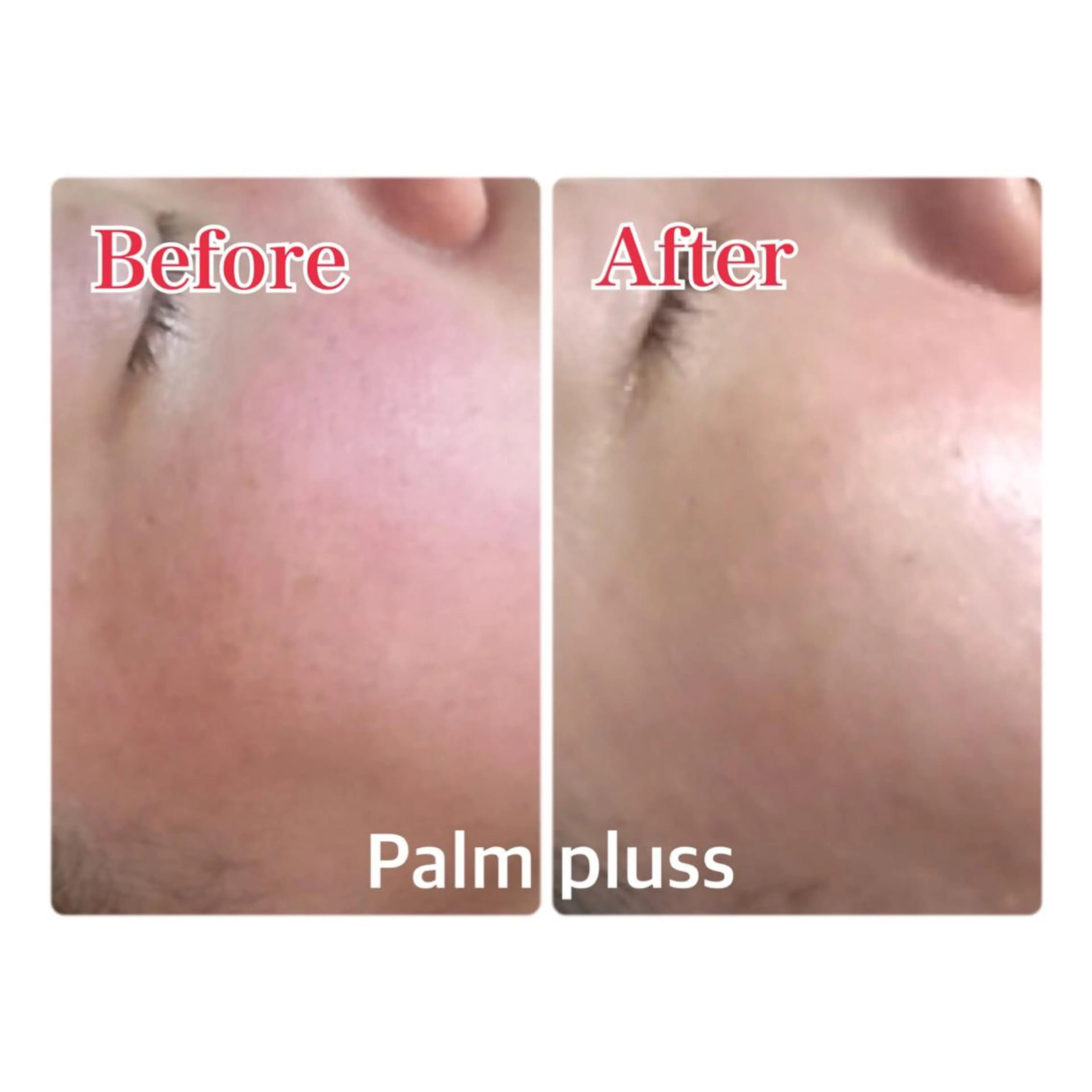 Kalnicco (カルニッコ)のエステ・リラクイメージ