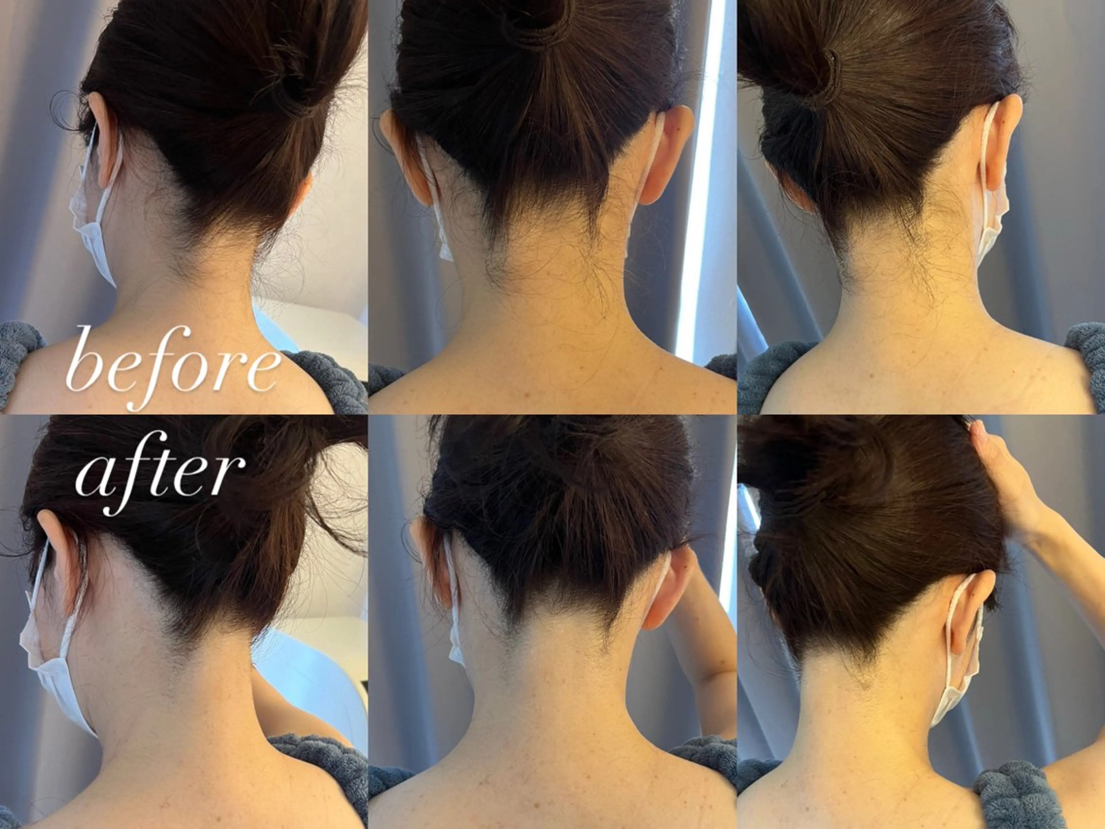 うなじ脱毛/美肌脱毛 LABELのエステ・リラクイメージ