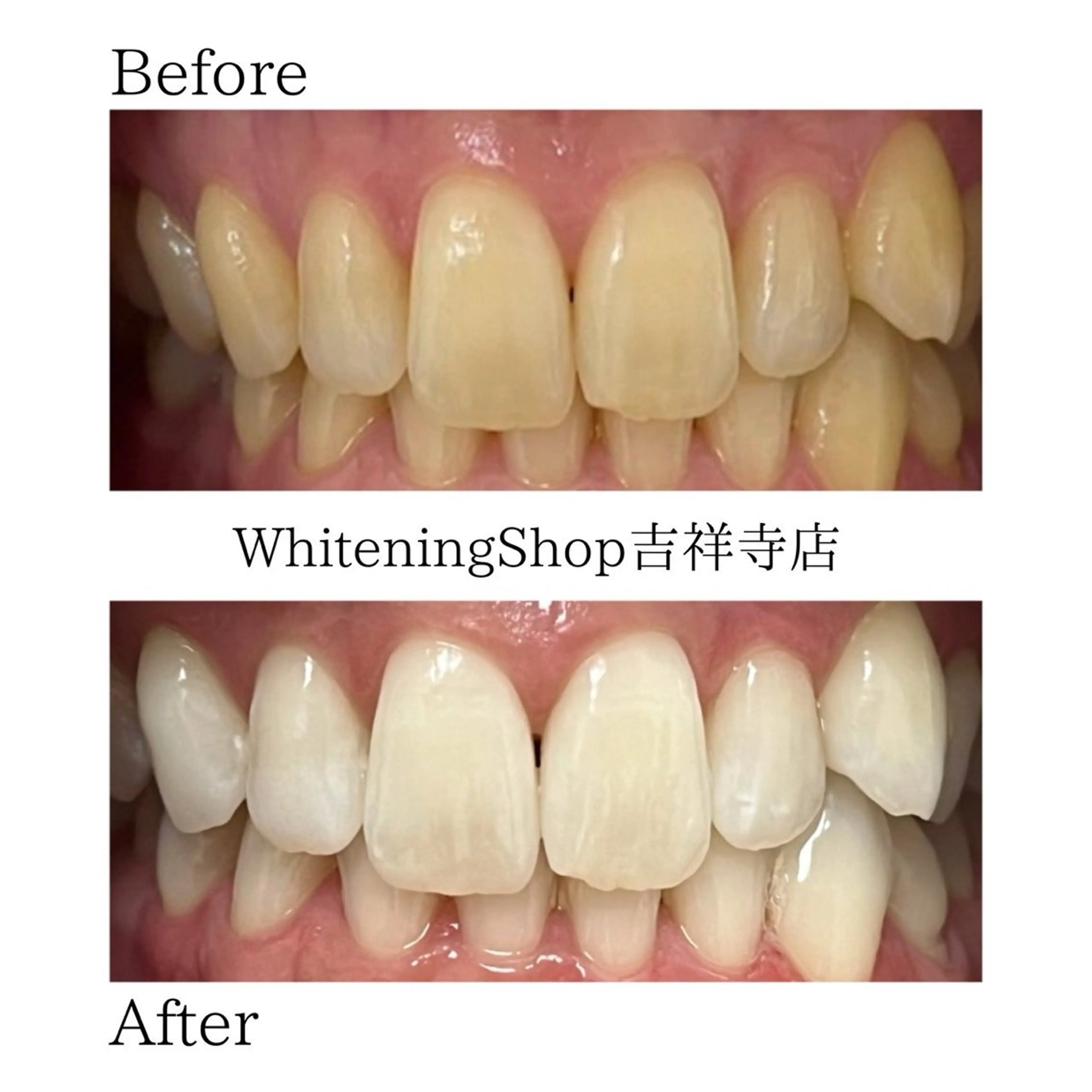 エステ リラク ホワイトニング ショップ吉祥寺店のエステ・リラクイメージ