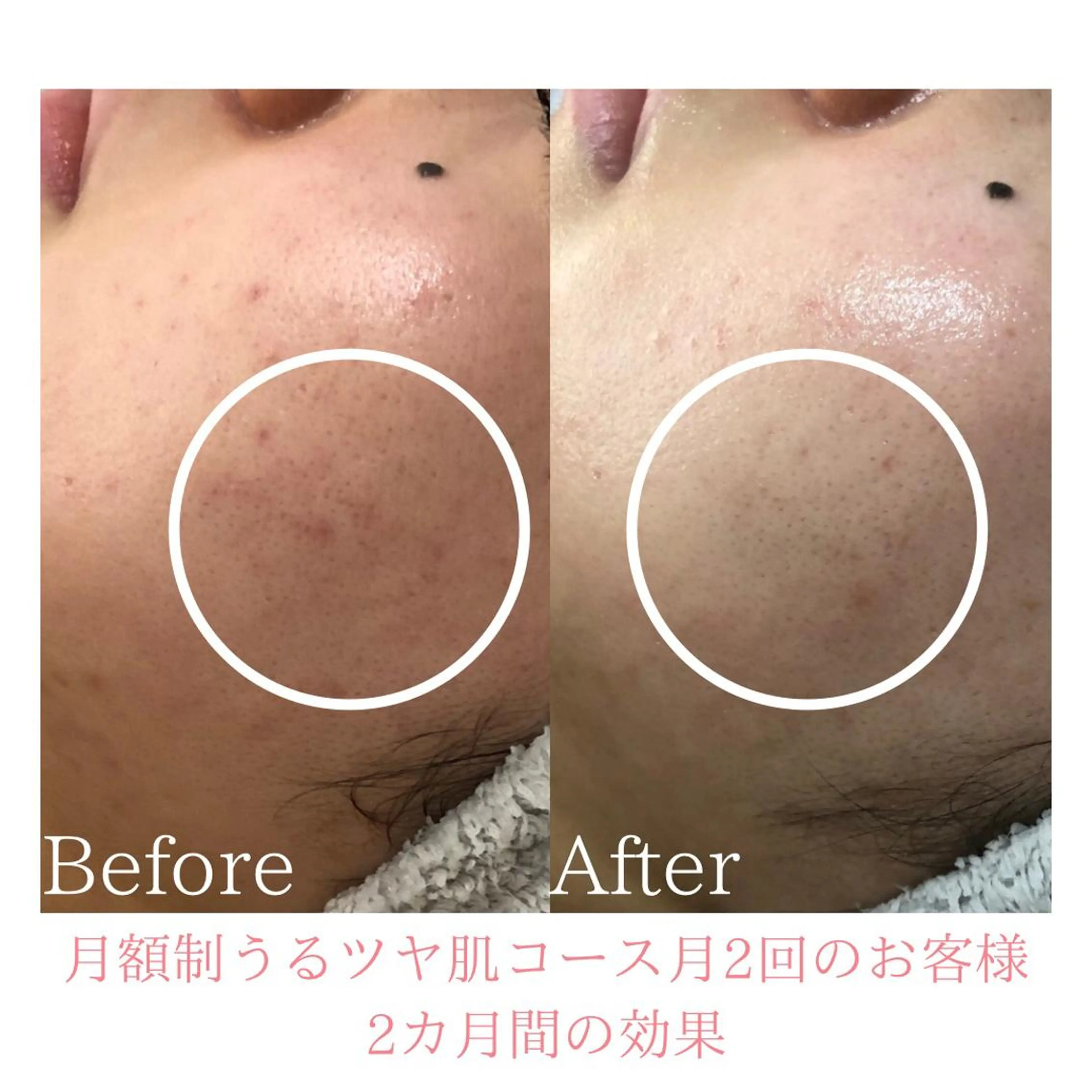 エステ BestBelleꕤ 大阪福島/肌質改善のエステ・リラクイメージ