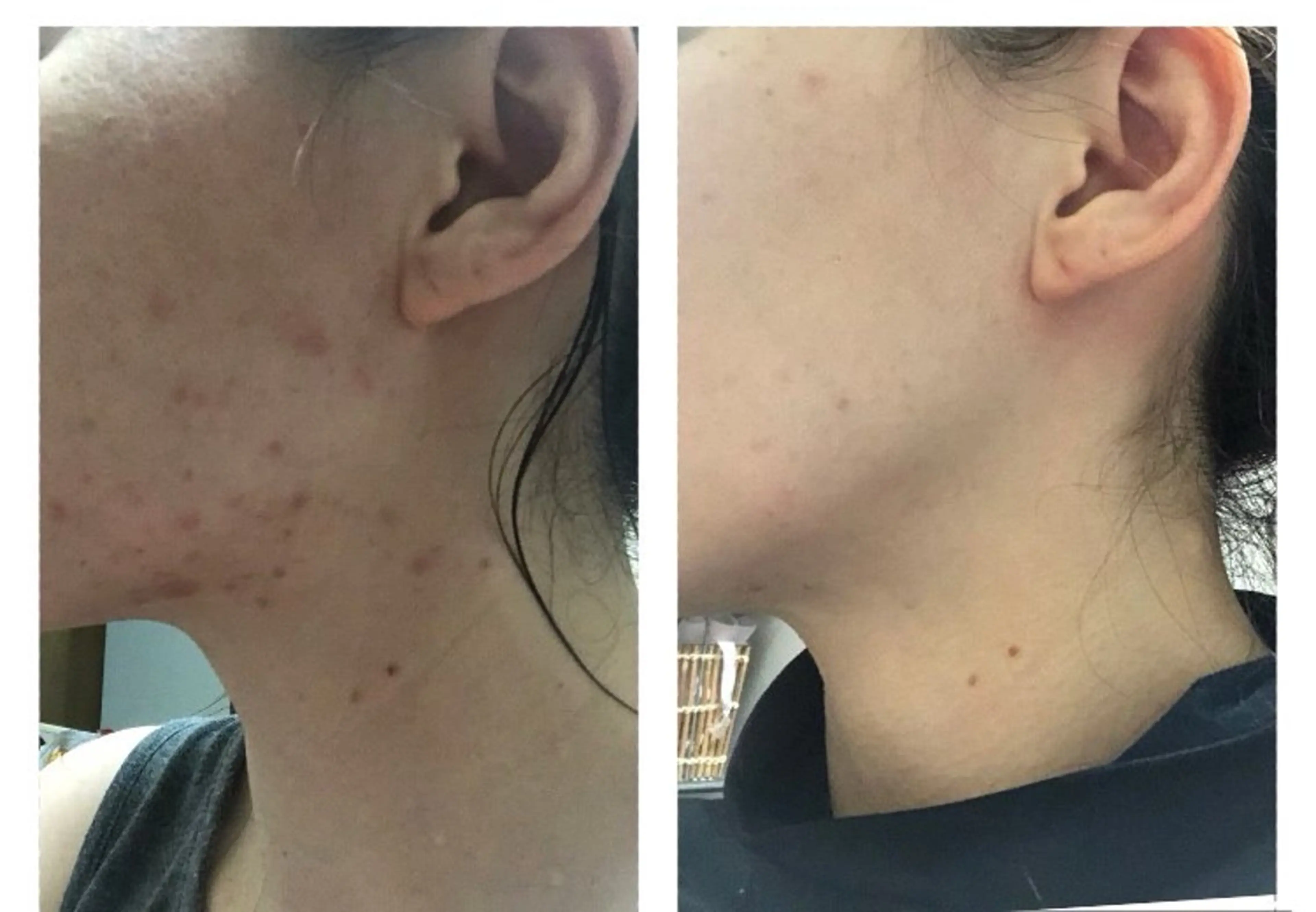 YOSAPARK jela 橋本のエステ・リラクイメージ