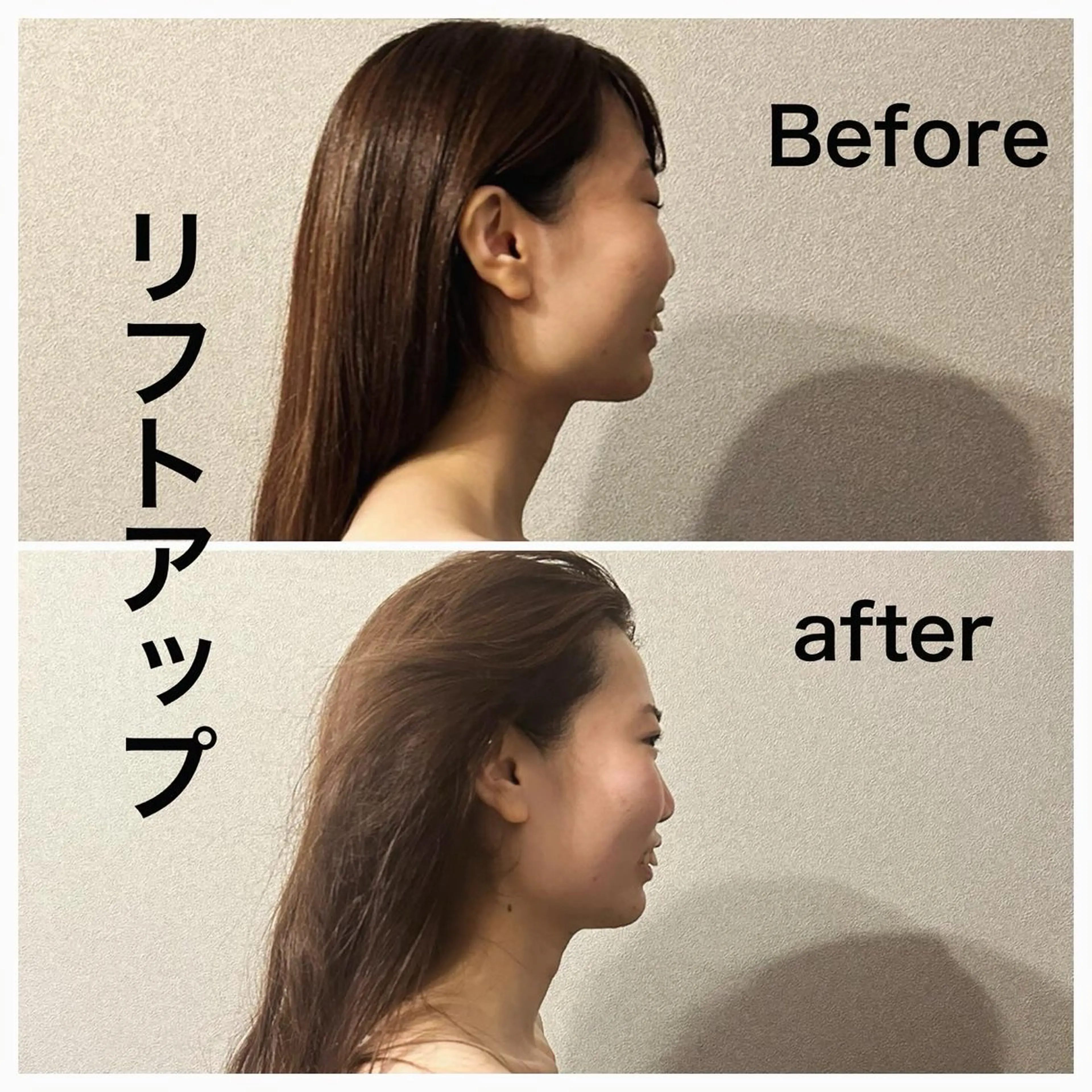 圧倒的たるみ改善 美容鍼エステのエステ・リラクイメージ