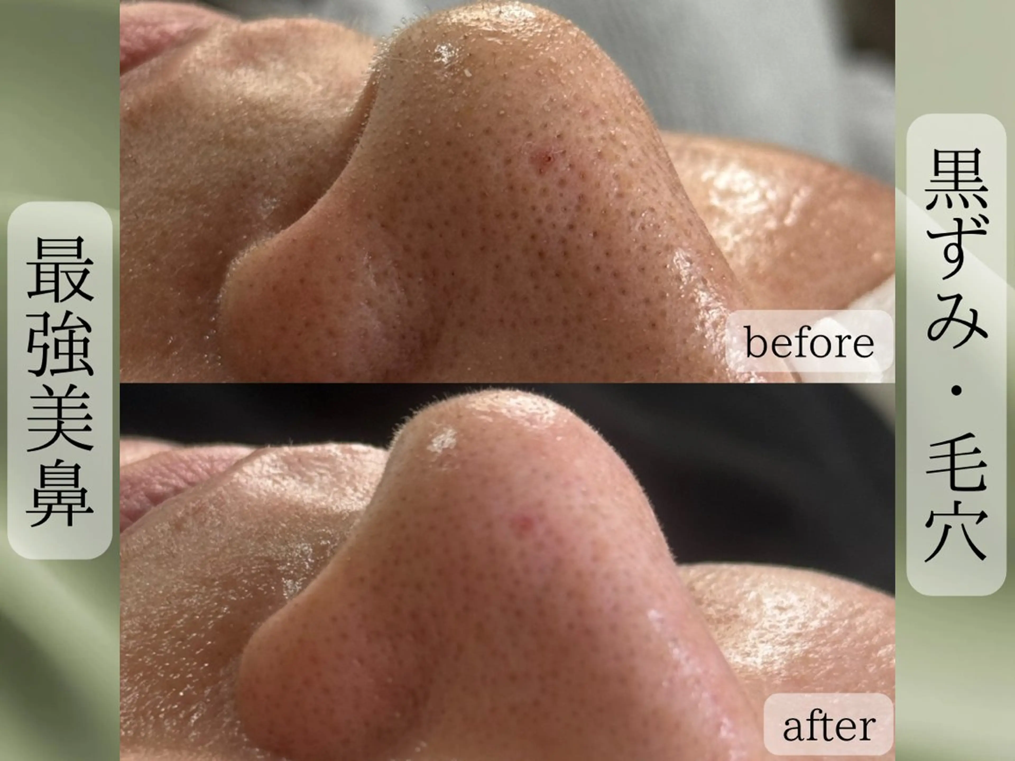 エステ Rairy Salon富士見町のエステ・リラクイメージ