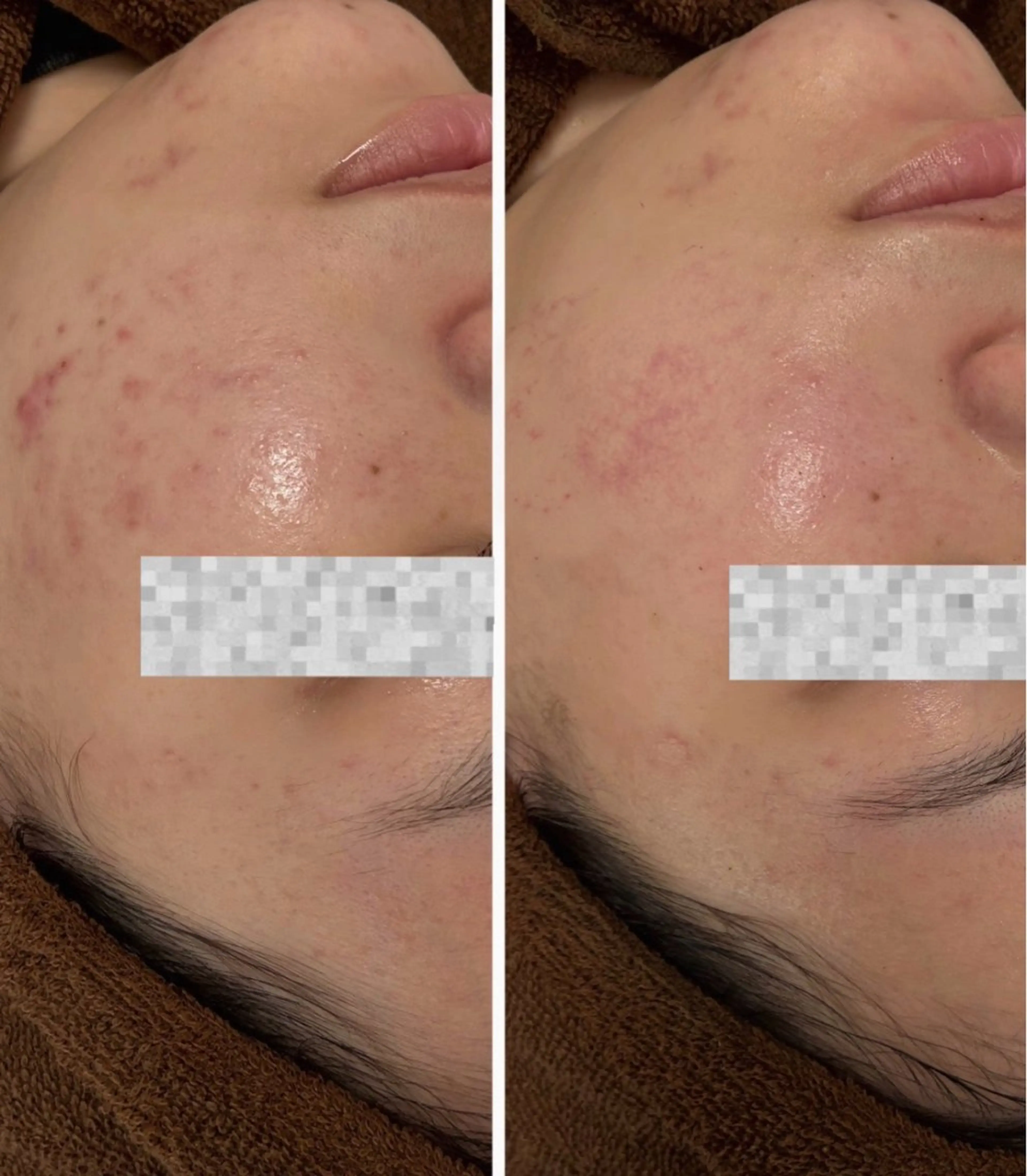 エステ Moena. 武蔵小杉🫧のエステ・リラクイメージ