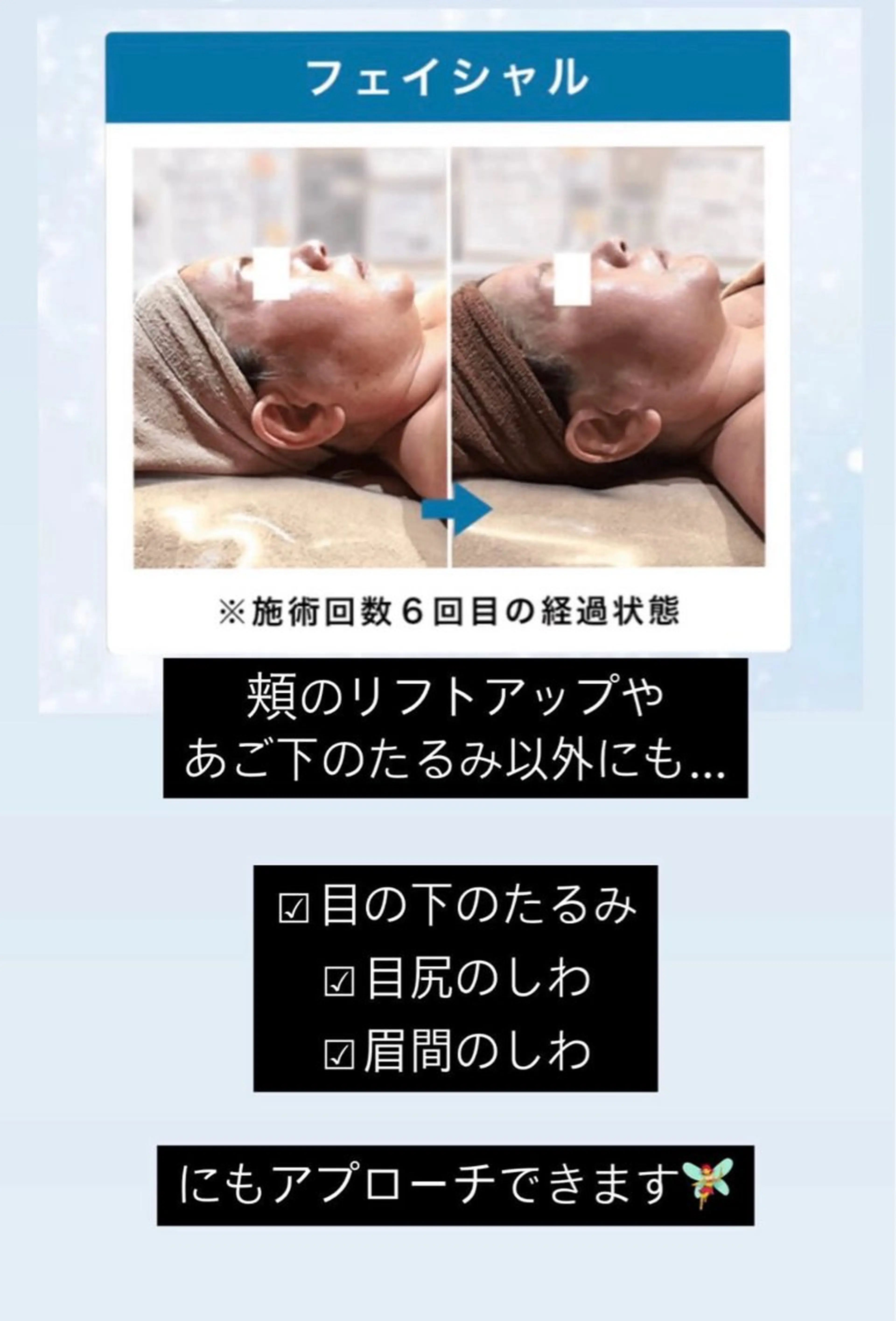 エステ BEAUTY SALON R'sのエステ・リラクイメージ