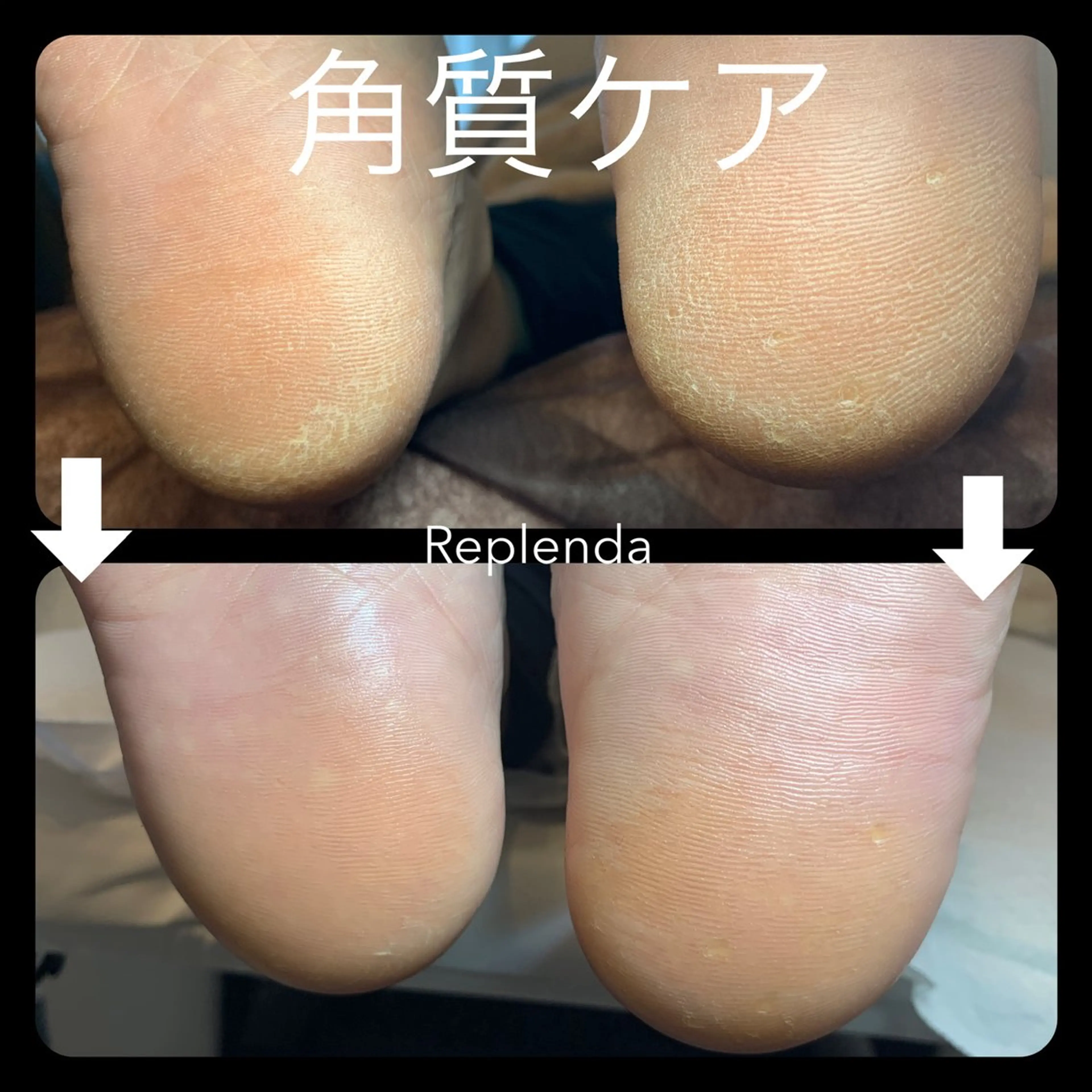 【ご新規様】フット足裏かかと角質ケアの写真
