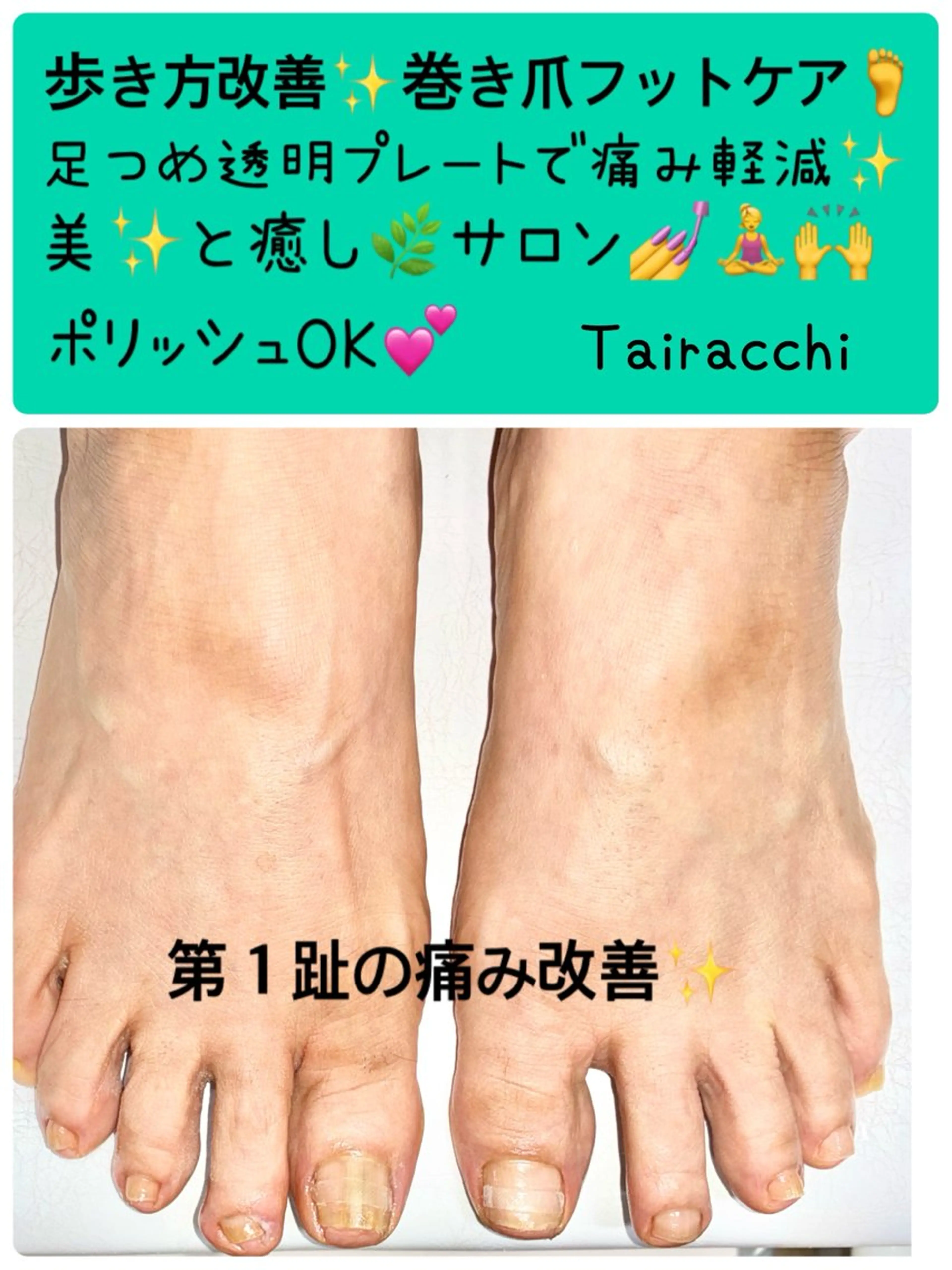 ネイル フットネイル Tairacchi タイラッチのネイルデザイン