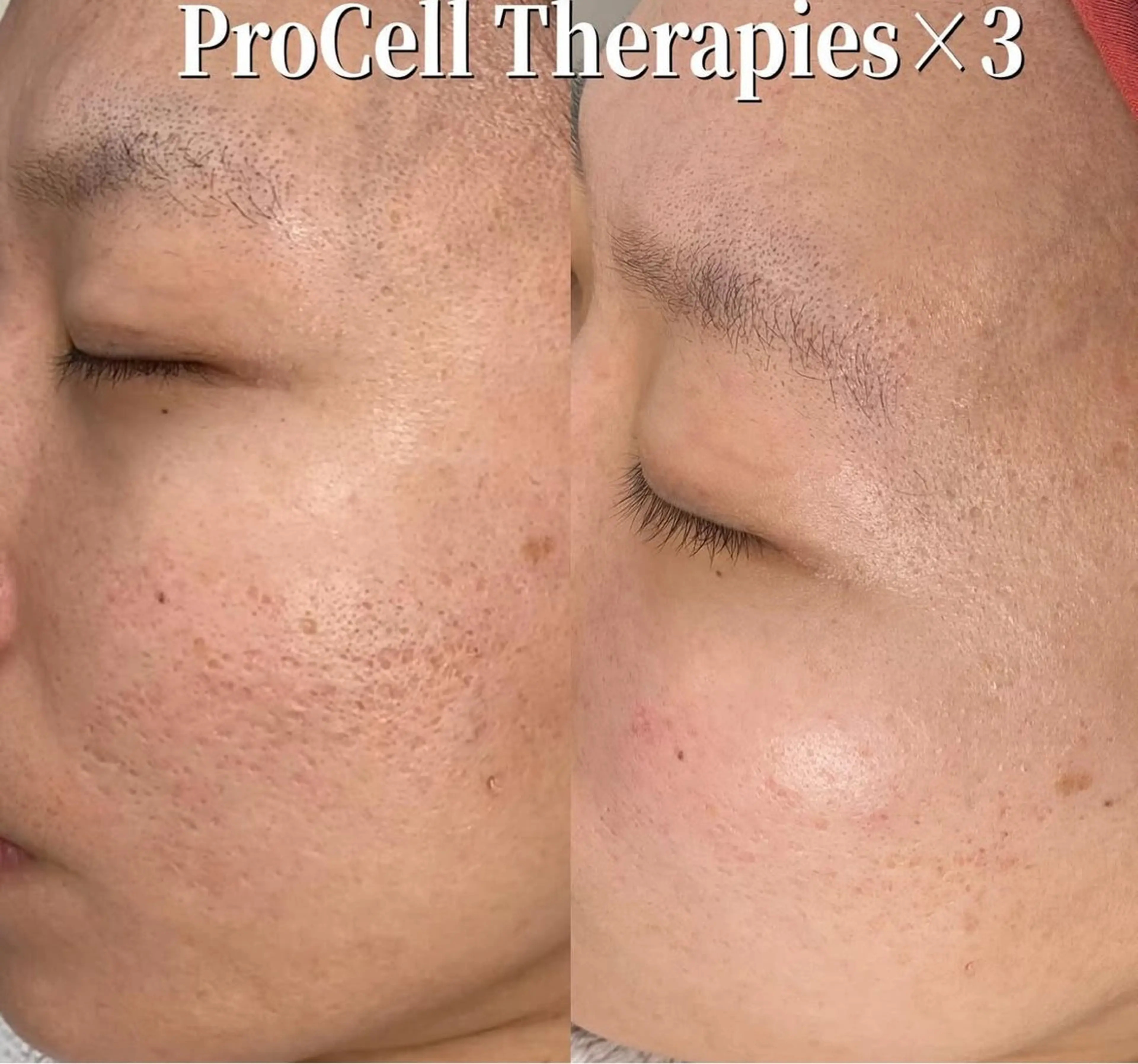 LOUISE. ／肌質・頭皮のエステ・リラクイメージ