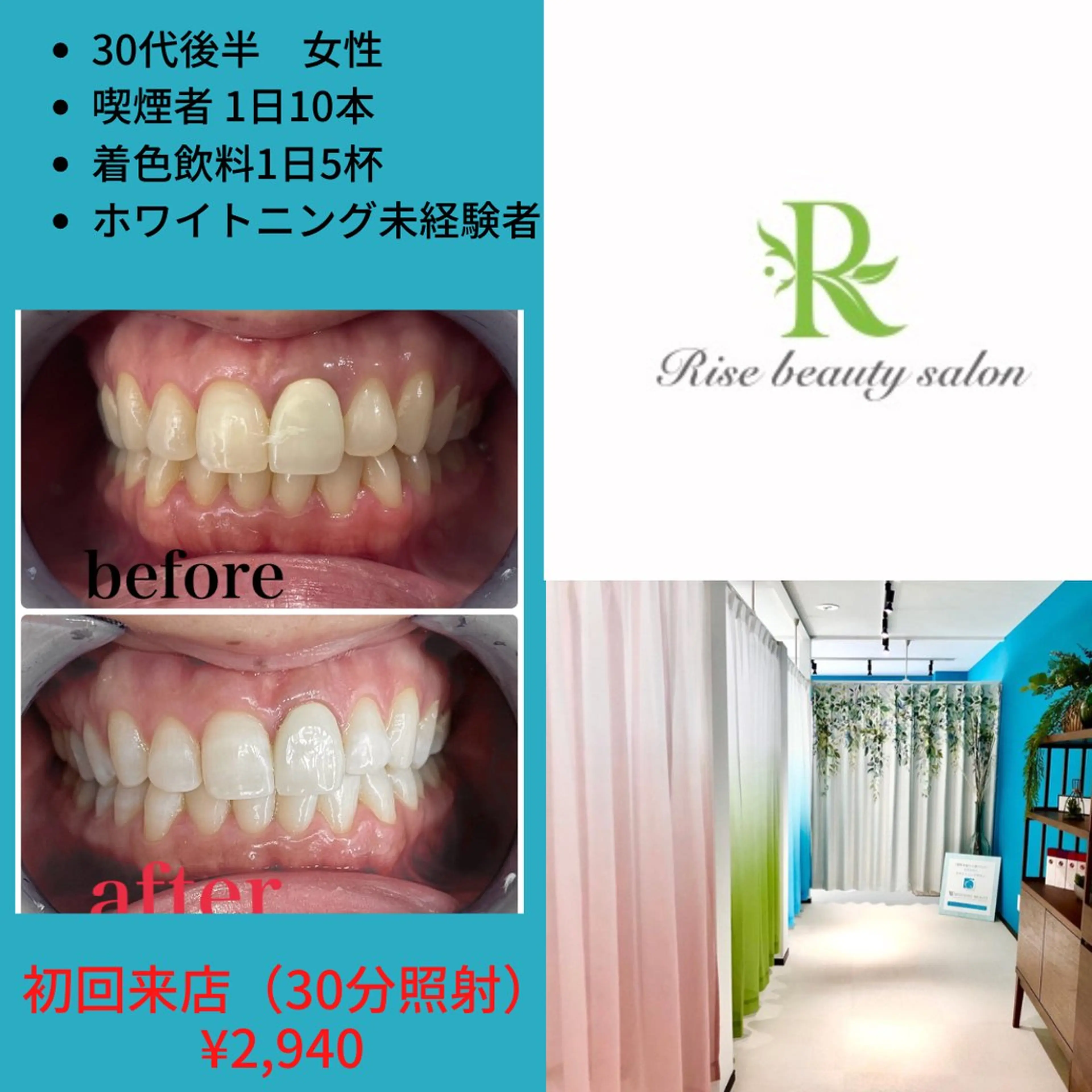 エステ リラク Rise beauty salon所属・RISE beaut y salonのエステ・リラクイメージ
