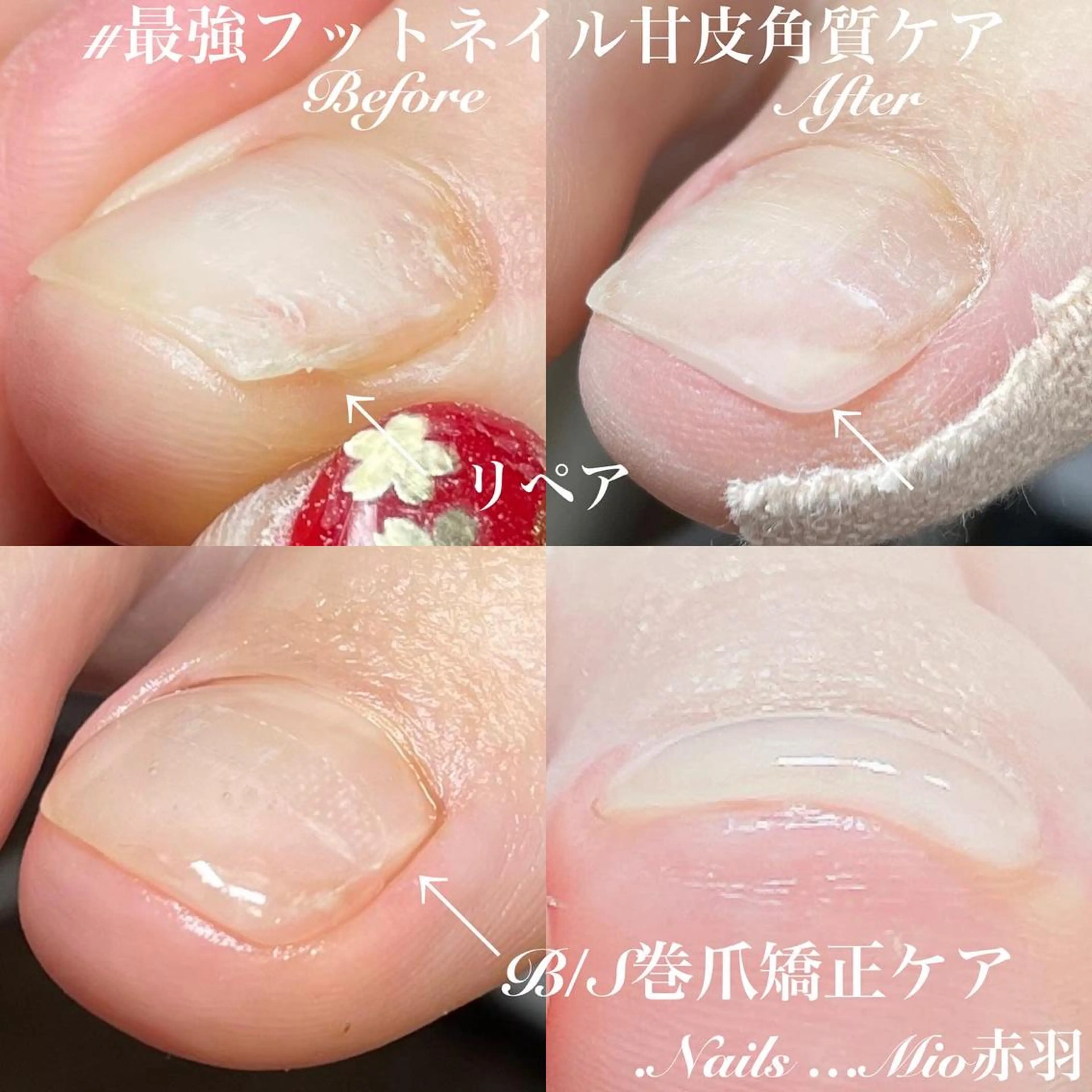 ネイル フットネイル ジェルネイル フットネイル .Nails Mio 赤羽西ネイルサロンのネイルデザイン