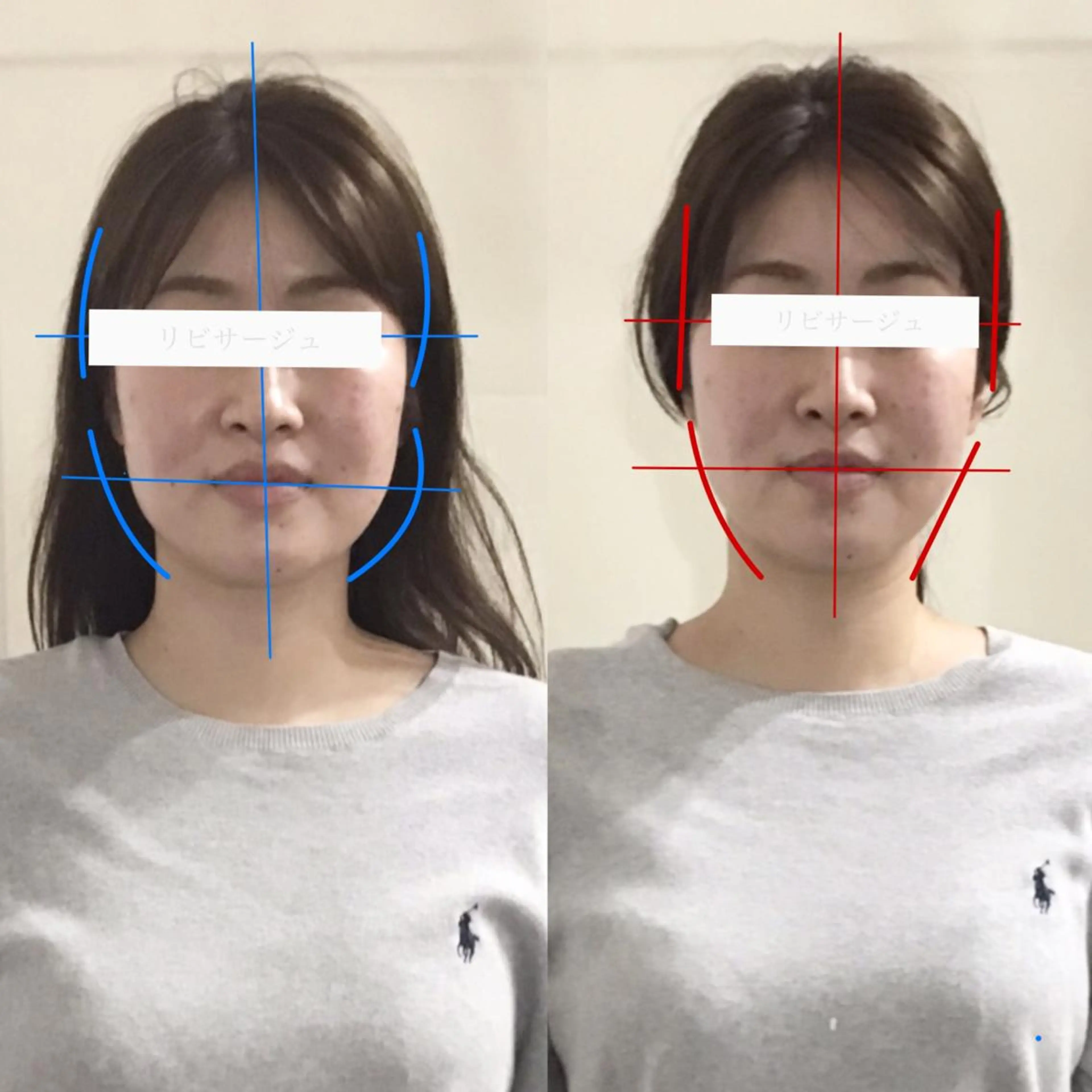 顔の歪み矯正専門 宮内翔のエステ・リラクイメージ