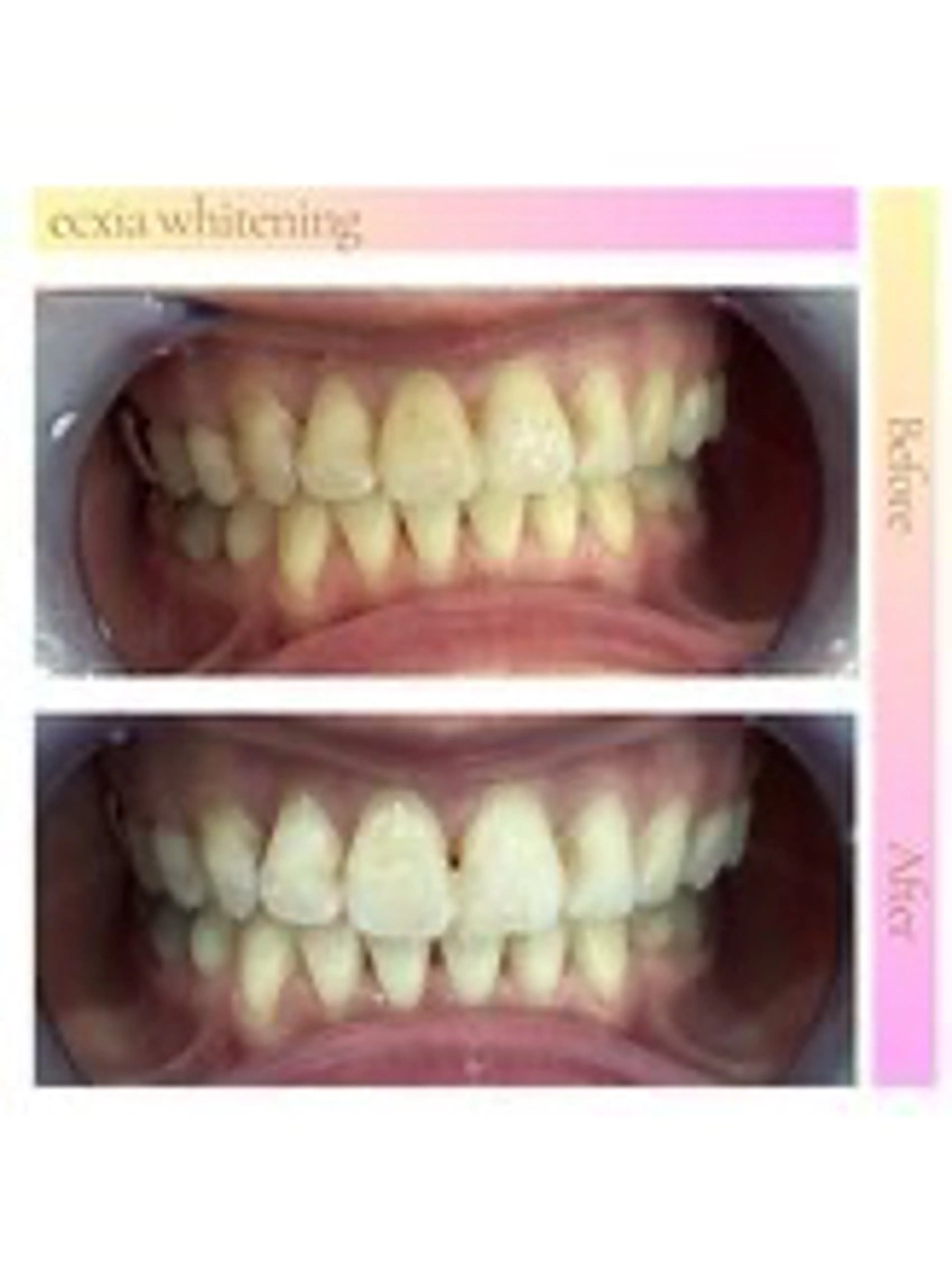 セルフホワイトニング エクシア西宮北口店のその他イメージ