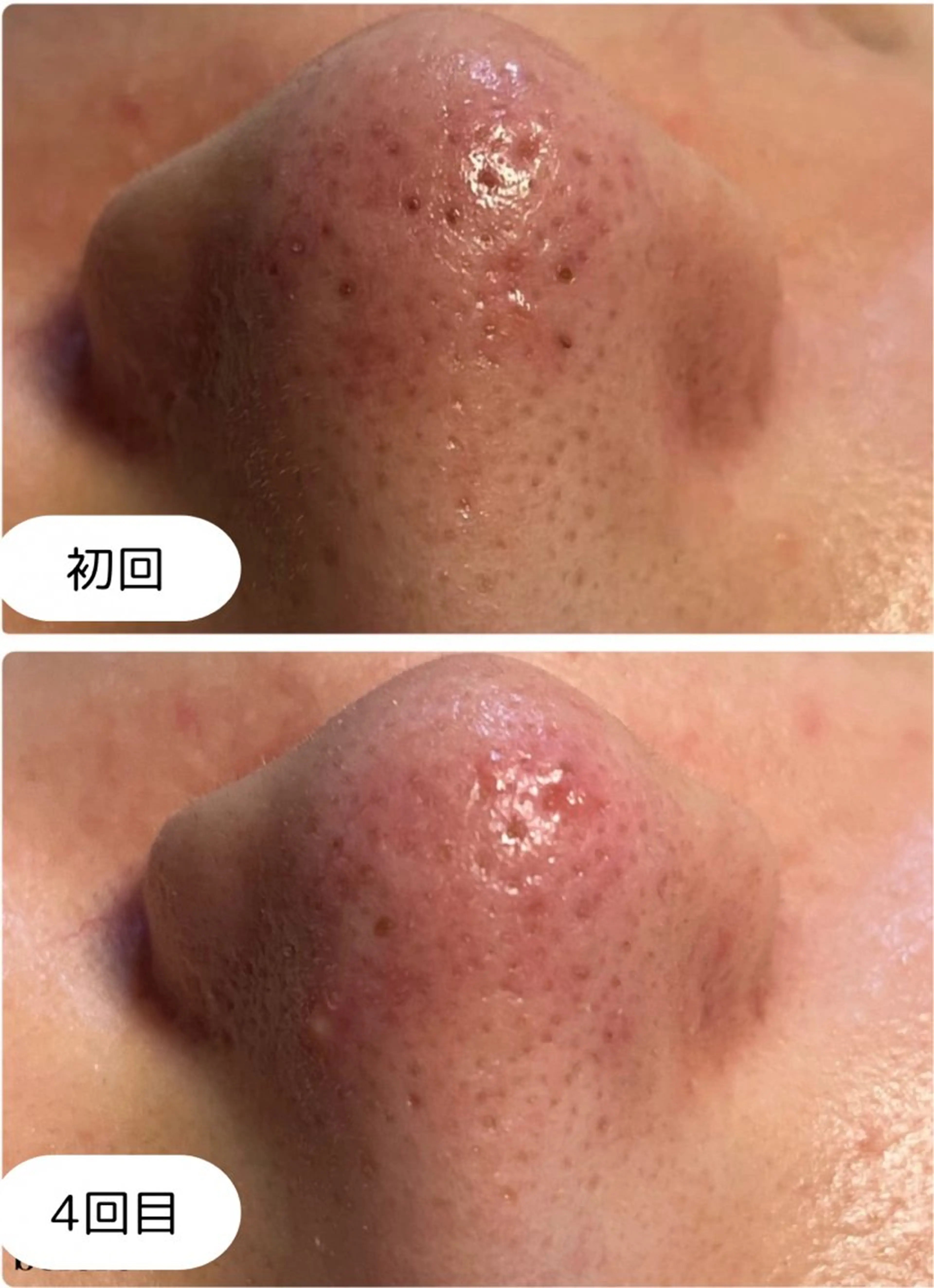 エステ ピーリング専門店 Belluteのエステ・リラクイメージ