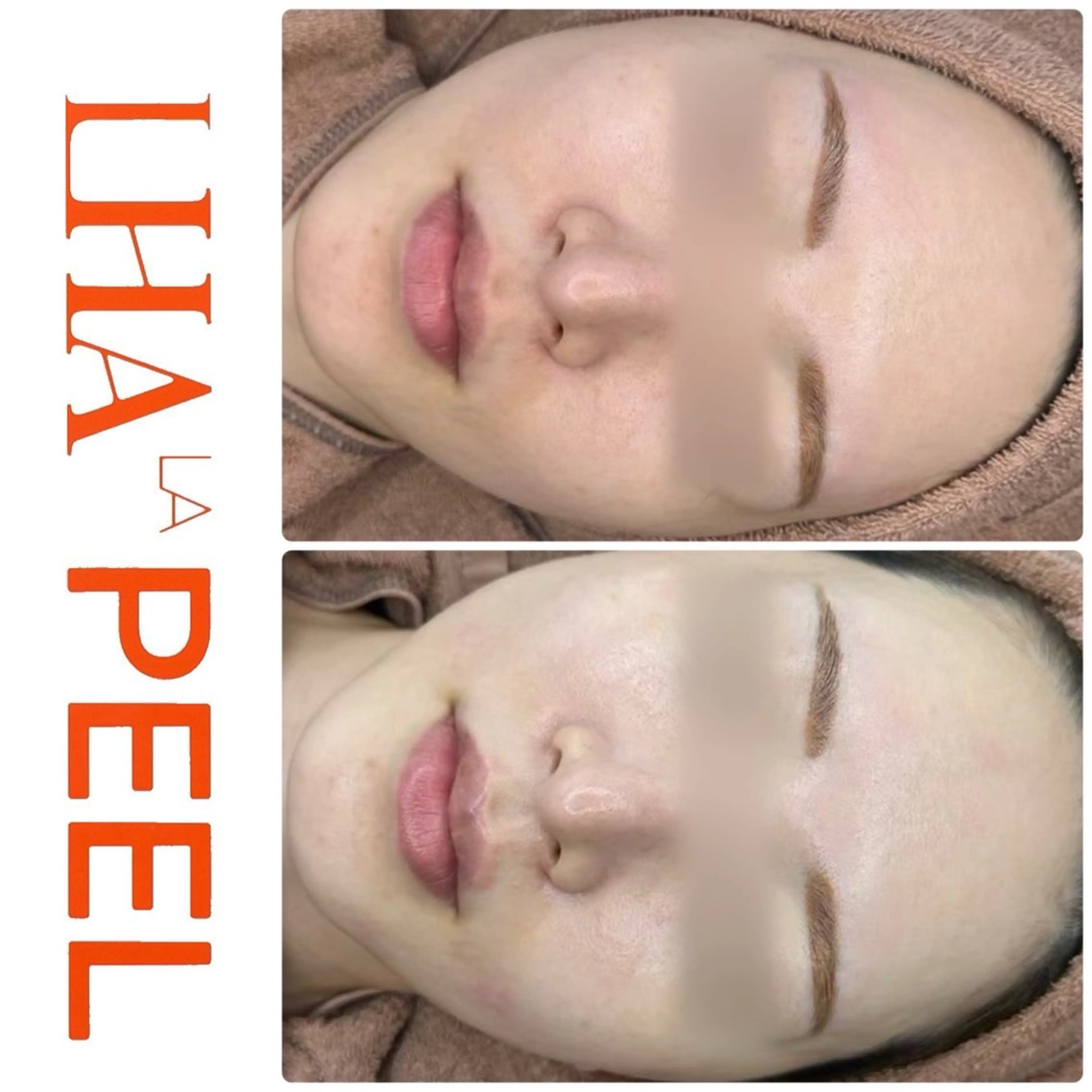 エステ ハーブピーリング専門 BIOEL横浜のエステ・リラクイメージ