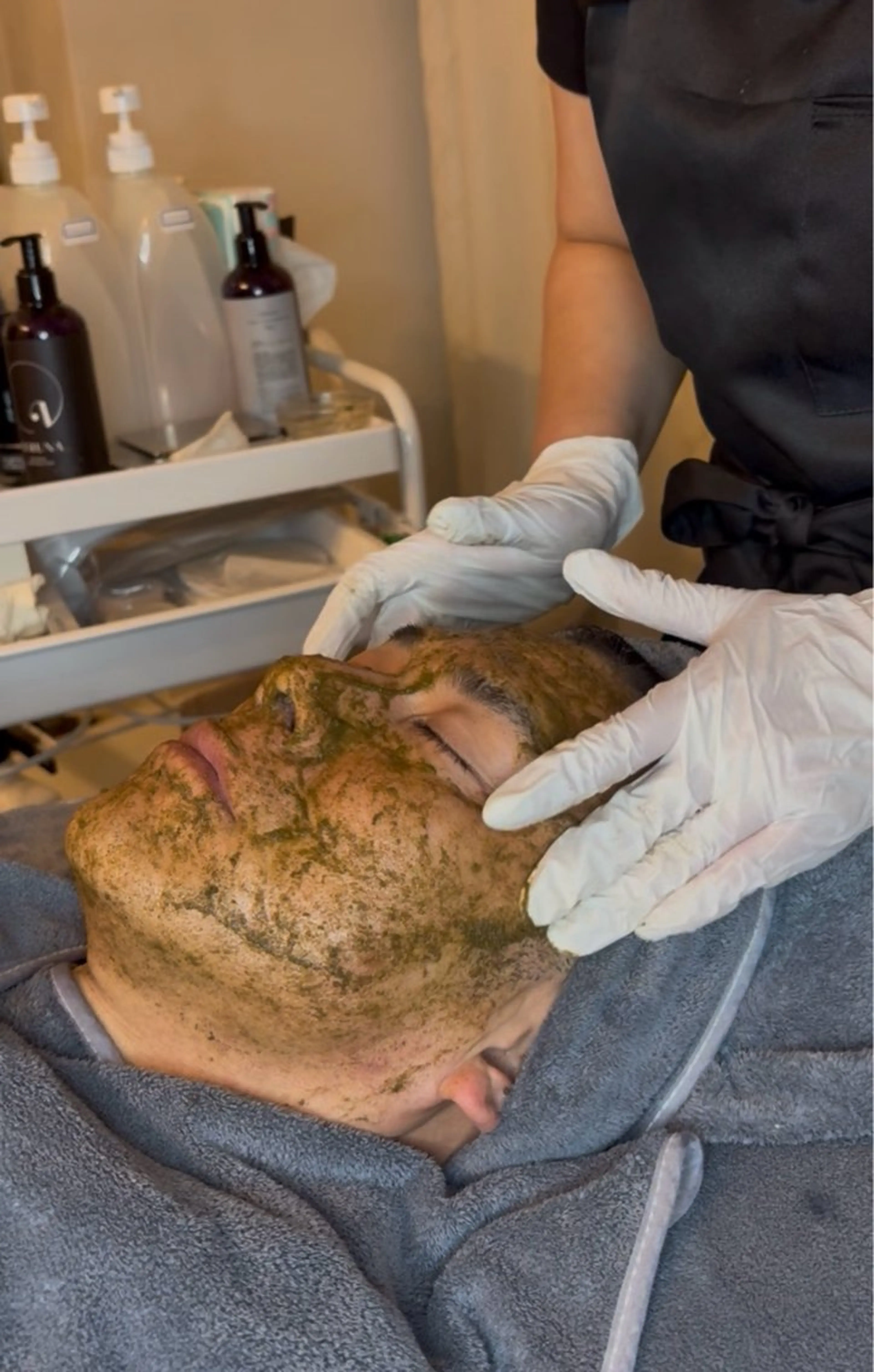 ハーブピーリング剥離あり🌿の写真