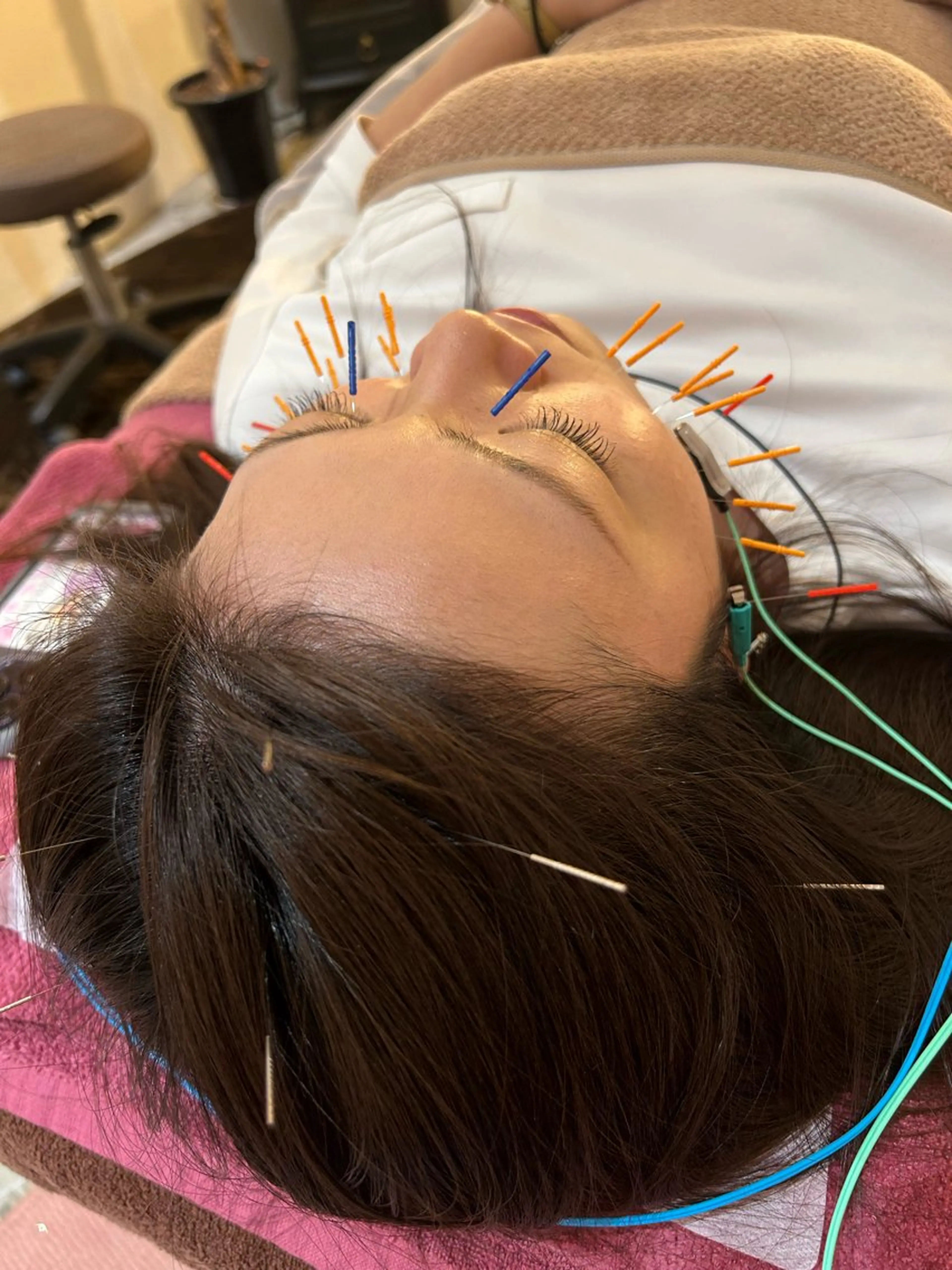 エステ リラク 美容鍼灸女性専用 りんご鍼灸治療院のその他イメージ